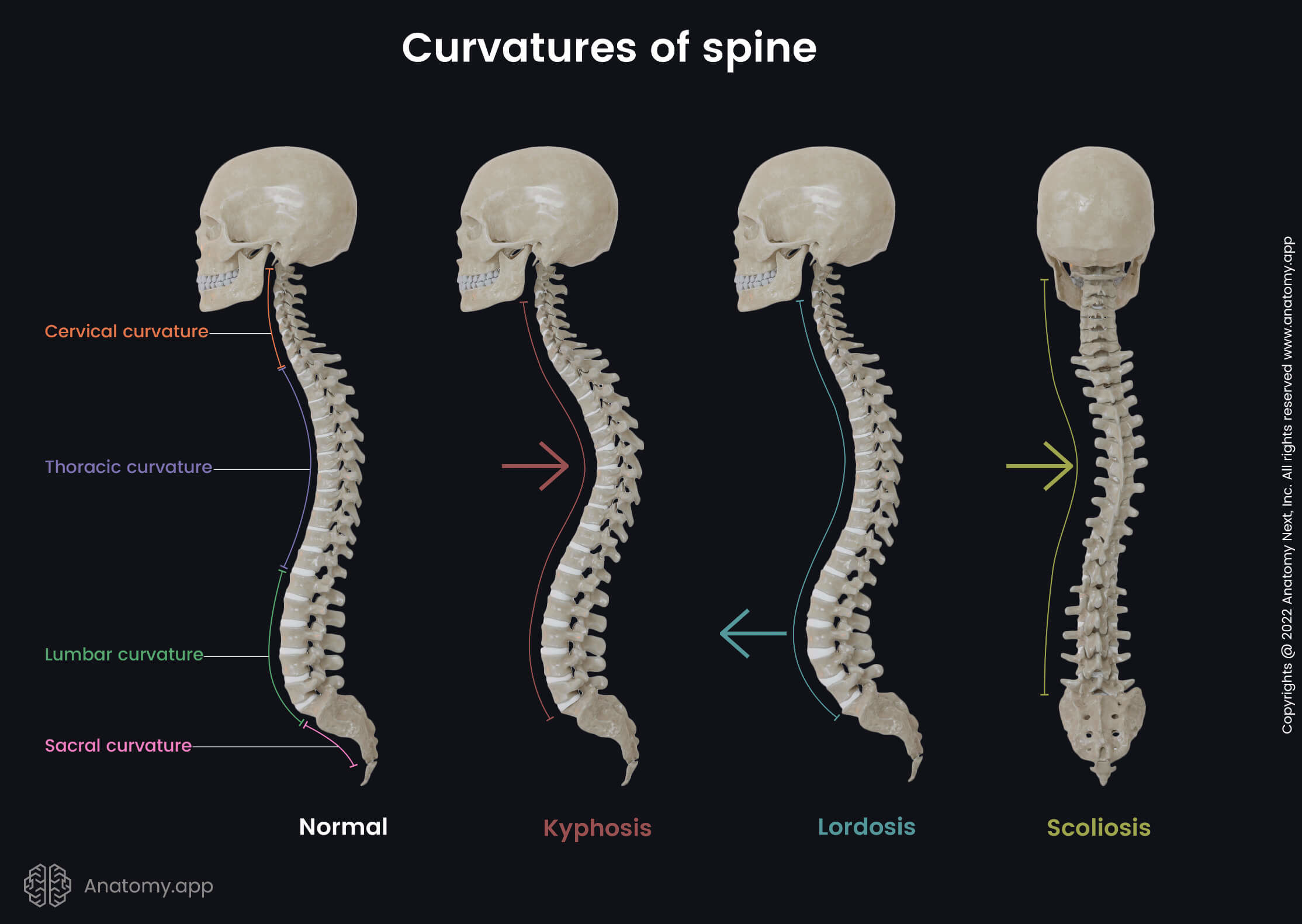 Spine, Vertebral column, Curvatures of spine, Curves of spine, Normal spine, Healthy spine, Cervical curvature, Thoracic curvature, Lumbar curvature, Sacral curvature, Vertebrae, Skeleton of trunk, Human skeleton, Pathological curvatures, Pathological spine, Kyphosis, Lordosis, Scoliosis