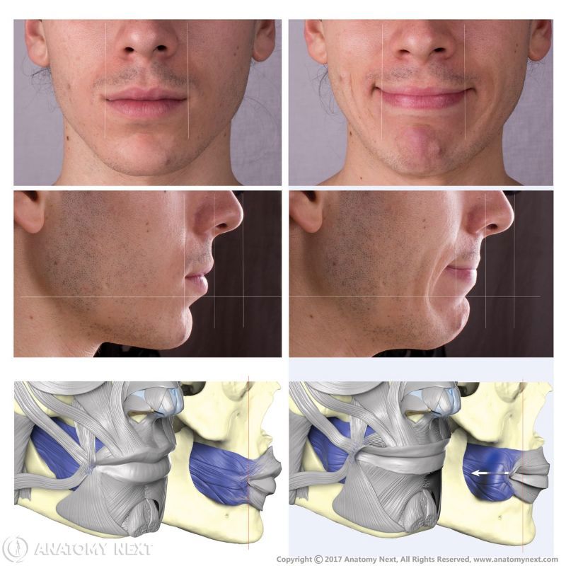 Action of buccinator muscle