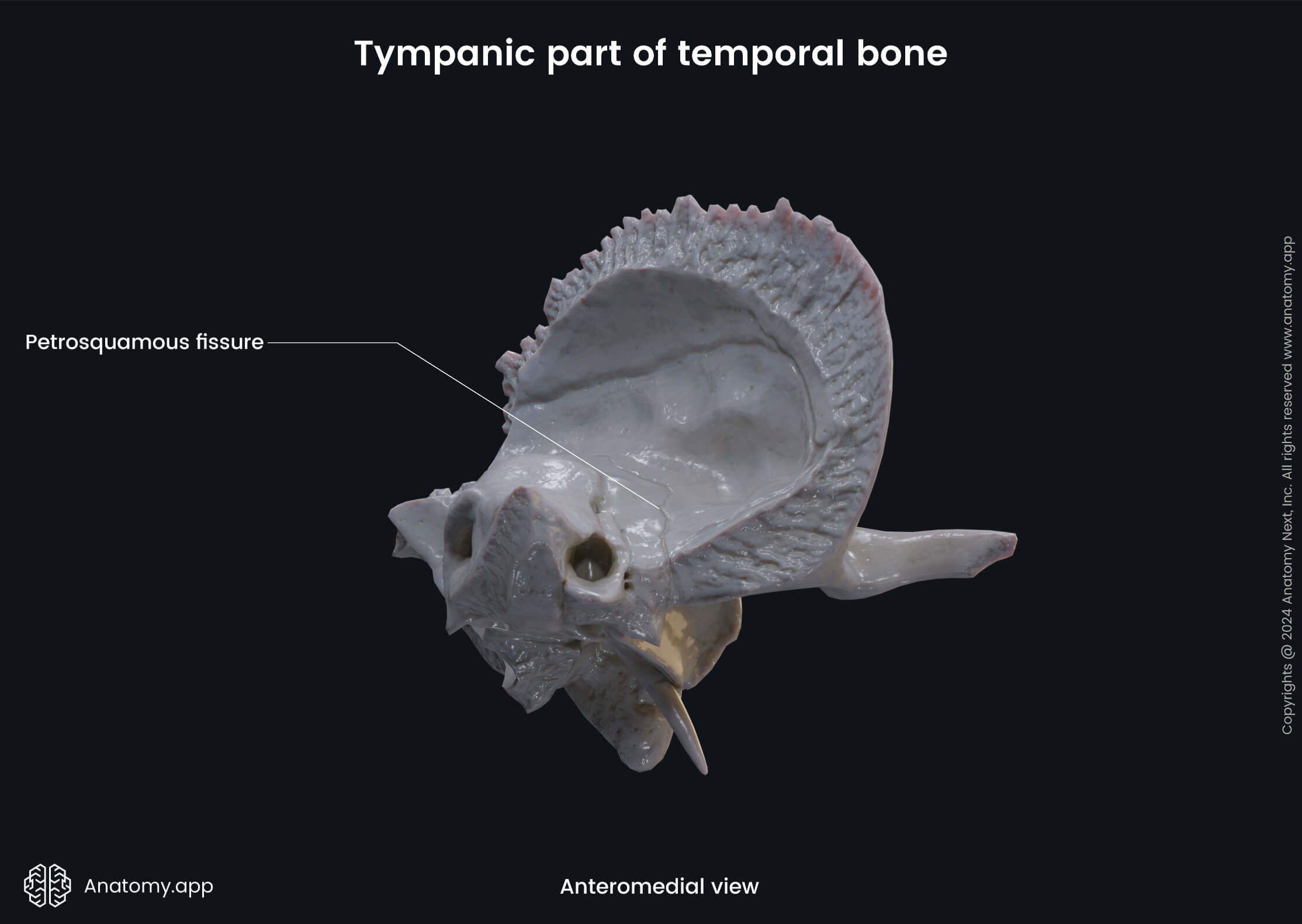 Head and neck, Skull, Cranium, Skeletal system, Neurocranium, Temporal bone, Tympanic part, Landmarks, Anteromedial view