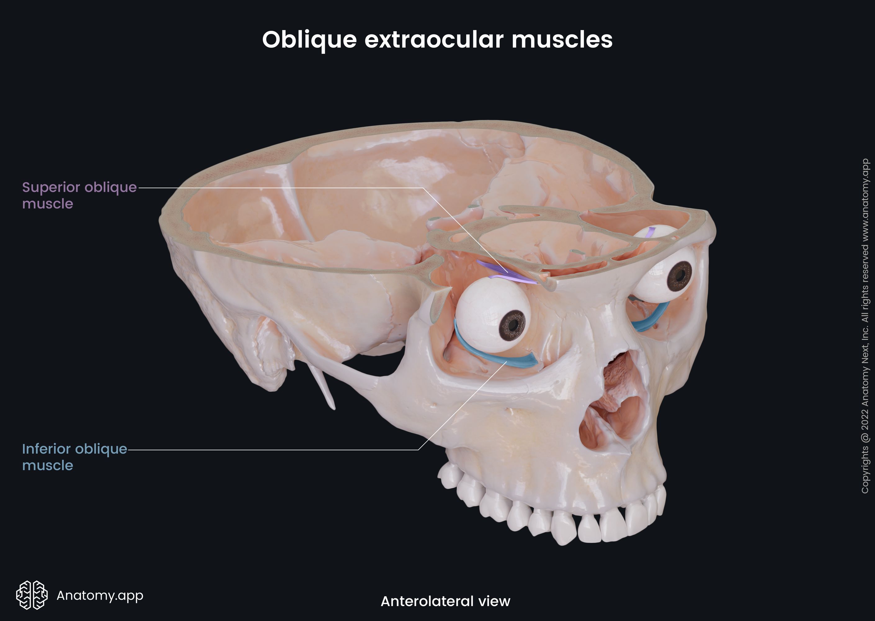 Extraocular muscles, Oblique muscles, Superior oblique, Inferior oblique, Bony orbit, Skull, Anterolateral view