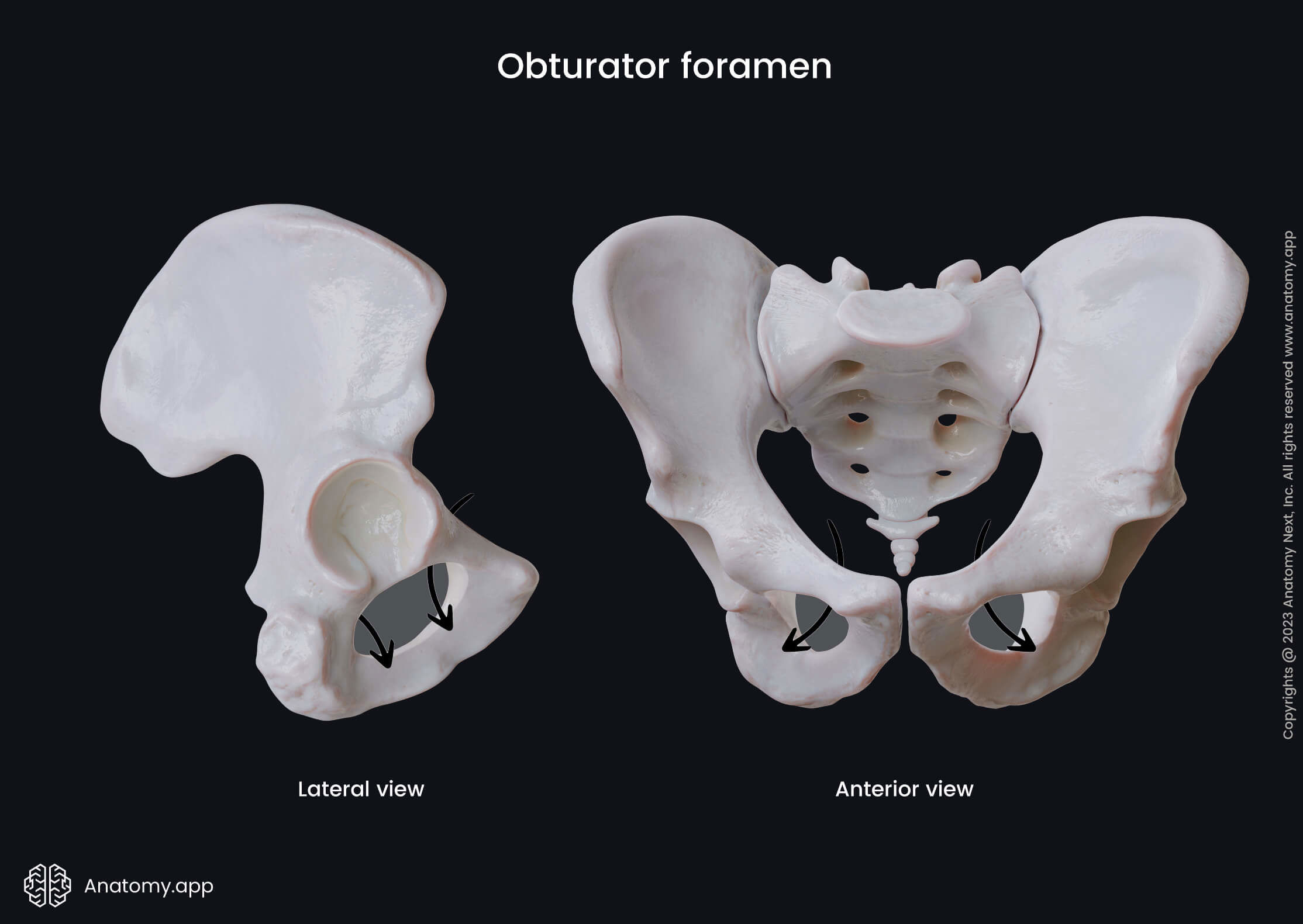 Pelvis, Hip bone, Landmarks, Obturator foramen, Lateral view, Anterior view