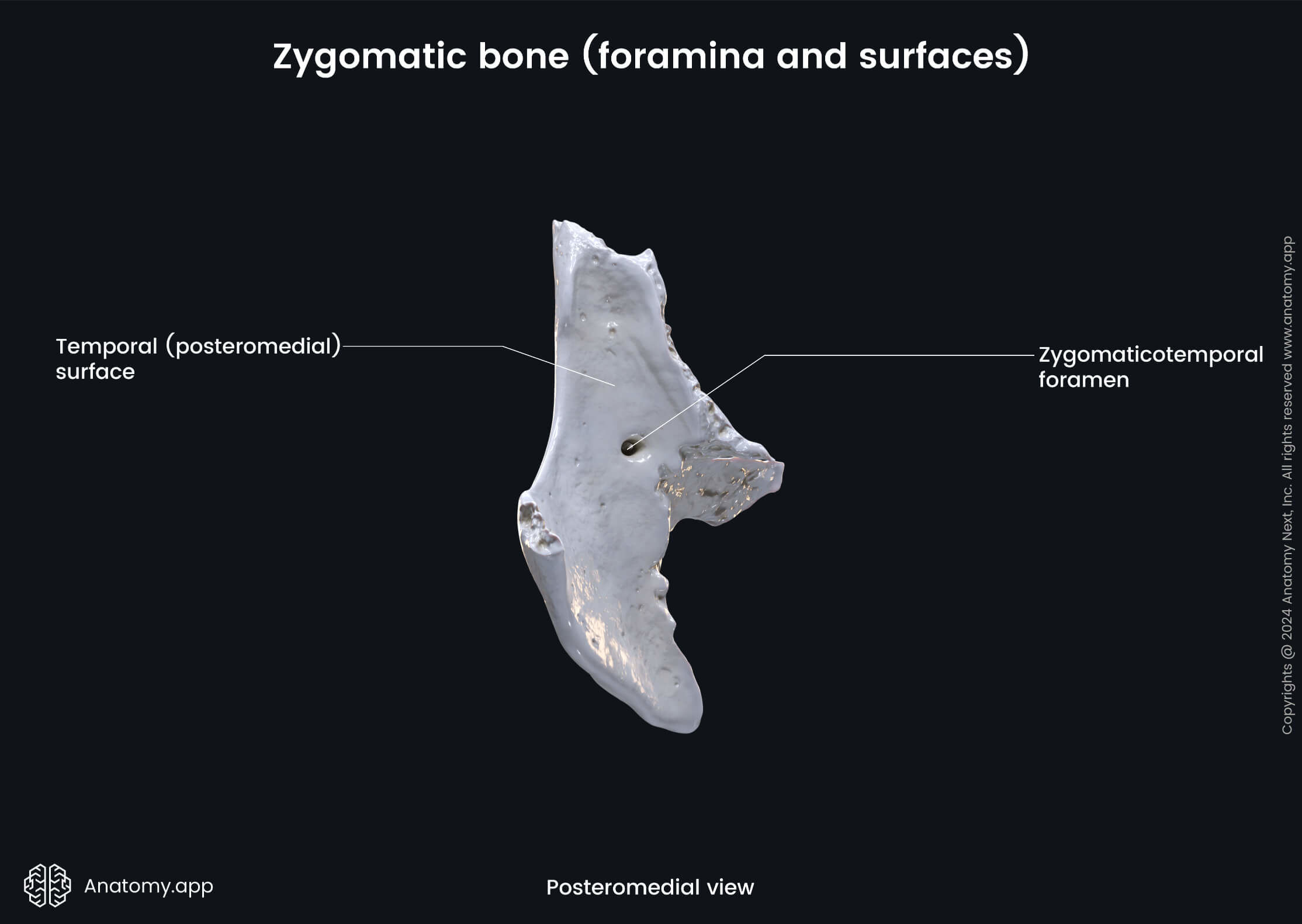 Head and neck, Skull, Viscerocranium, Facial skeleton, Zygomatic bone, Temporal surface, Landmarks of zygomatic bone, Medial view