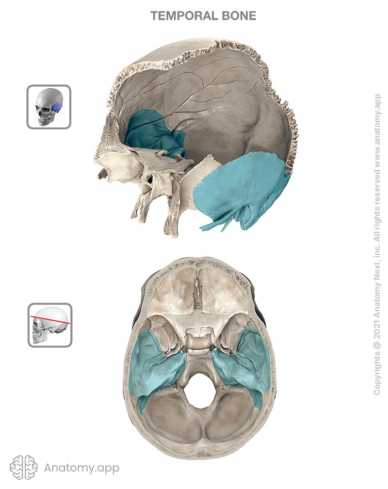 Temporal bone, colored, skull with removed parts, two views