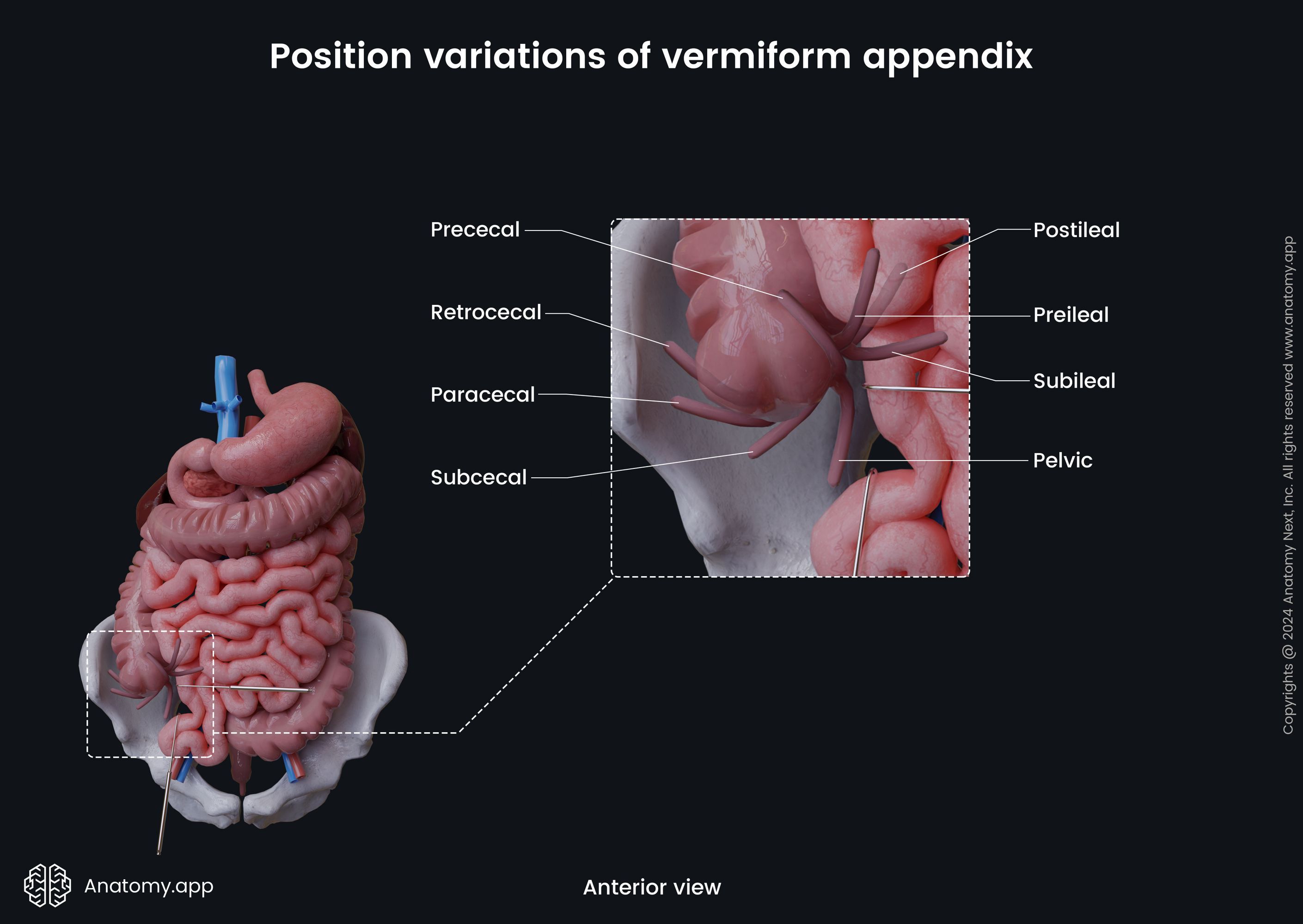 Position variations of vermiform appendix