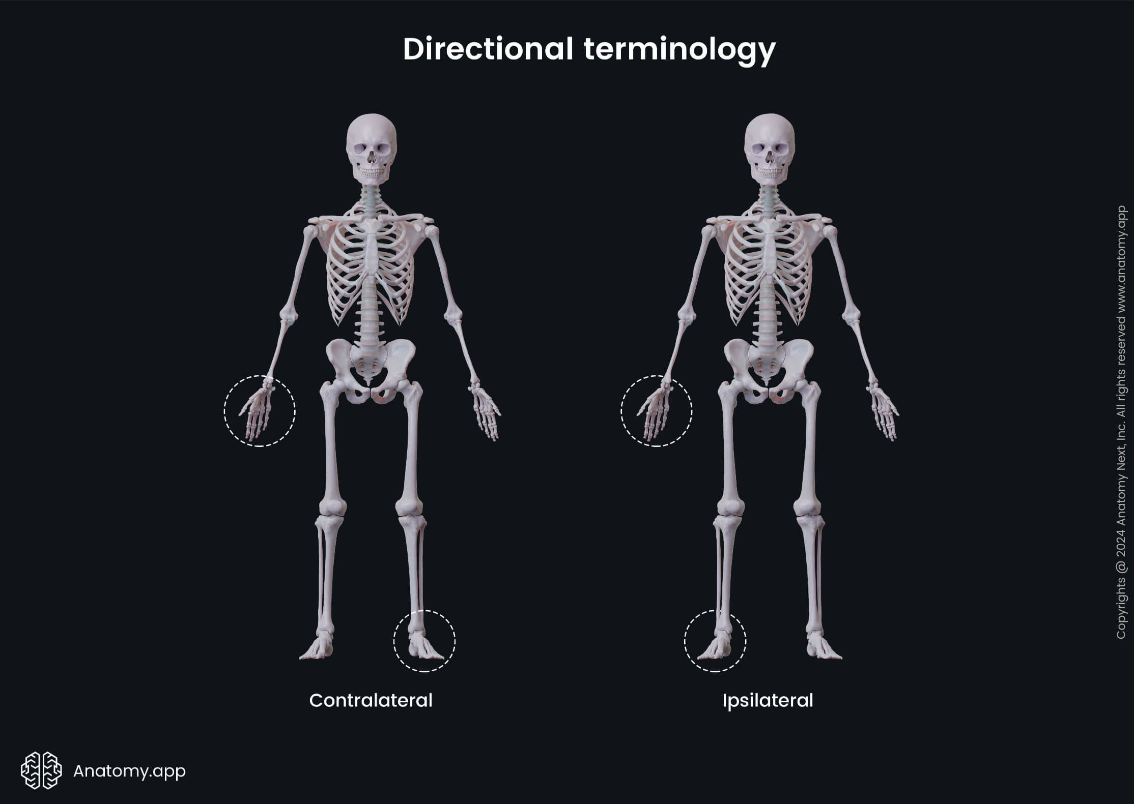 Directional terminology (contralateral and ipsilateral)