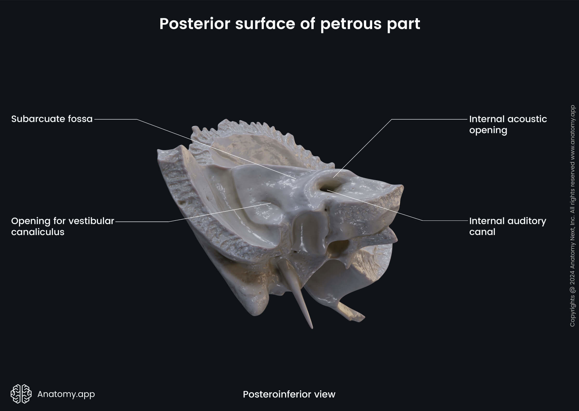 Head and neck, Skull, Cranium, Skeletal system, Neurocranium, Temporal bone, Petrous part, Landmarks, Posterior surface, Posteroinferior view