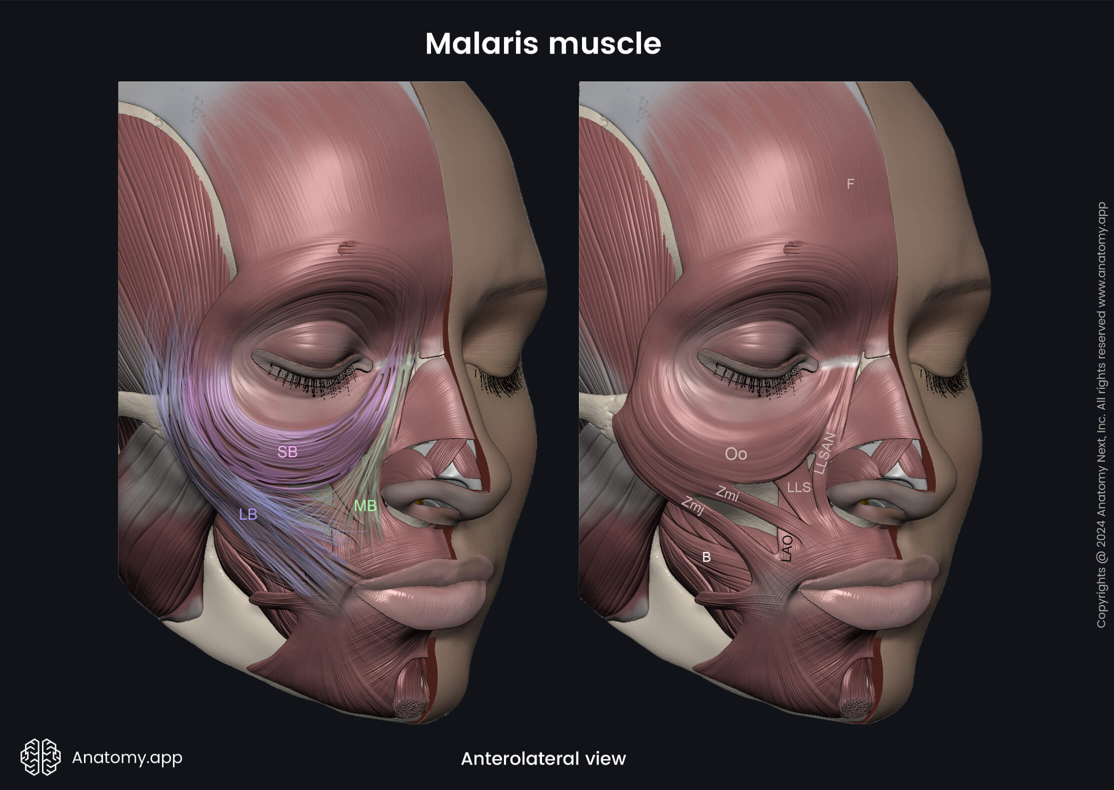 Head and neck, Facial muscles, Malaris muscle, Structure, Lateral band, Medial band, Suspending band, Anterolateral view