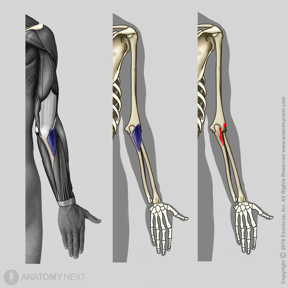 Anconeus, Origin of anconeus, Insertion of anconeus, Muscles of upper limb, Muscles of upper arm, Posterior compartment muscles, Posterior compartment muscles of upper arm, Arm muscles