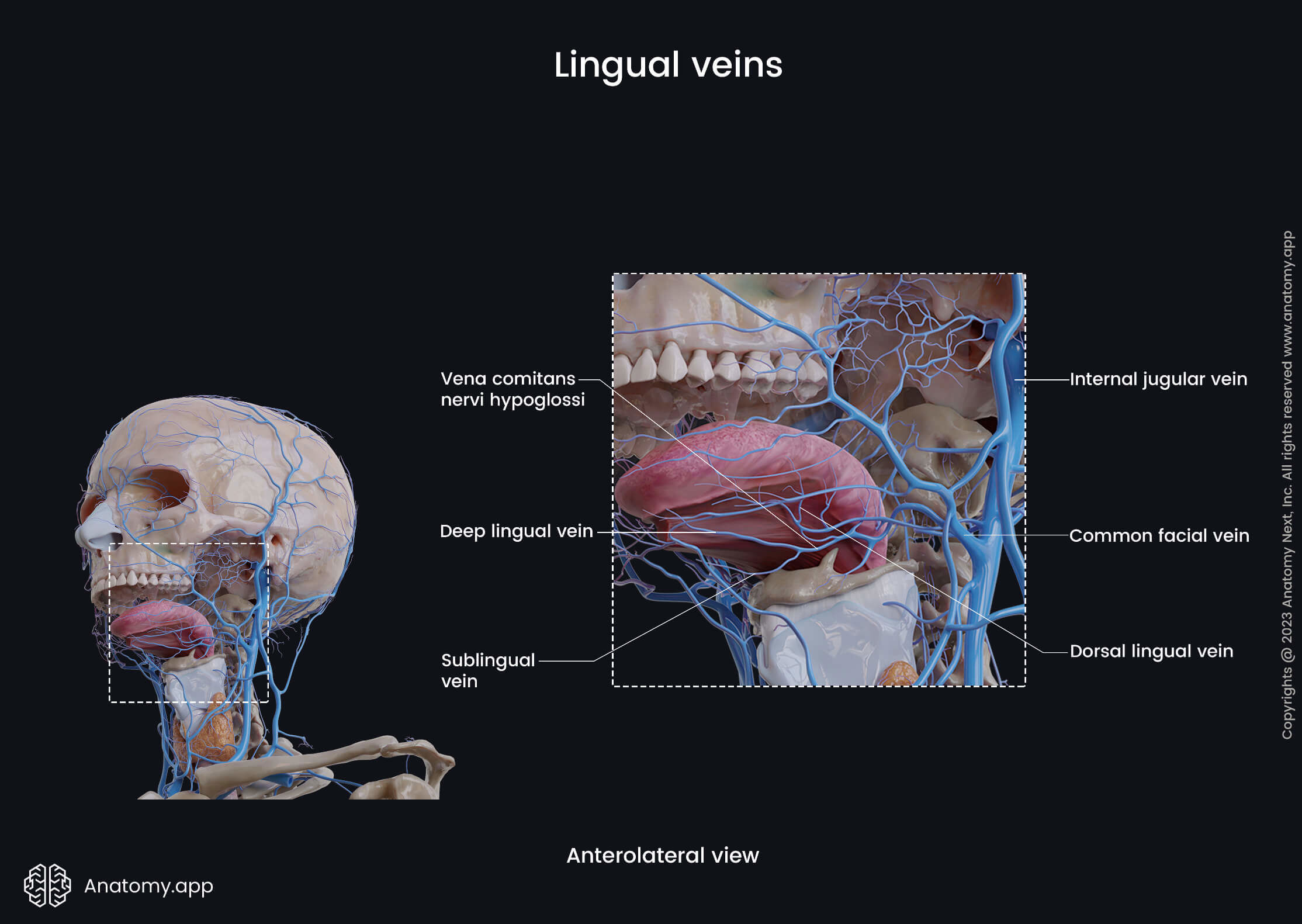 Veins of the head, Extracranial veins, Lingual veins, Sublingual vein, Deep lingual vein, Vena comitans nervi hypoglossi, Dorsal lingual vein, Anterolateral view