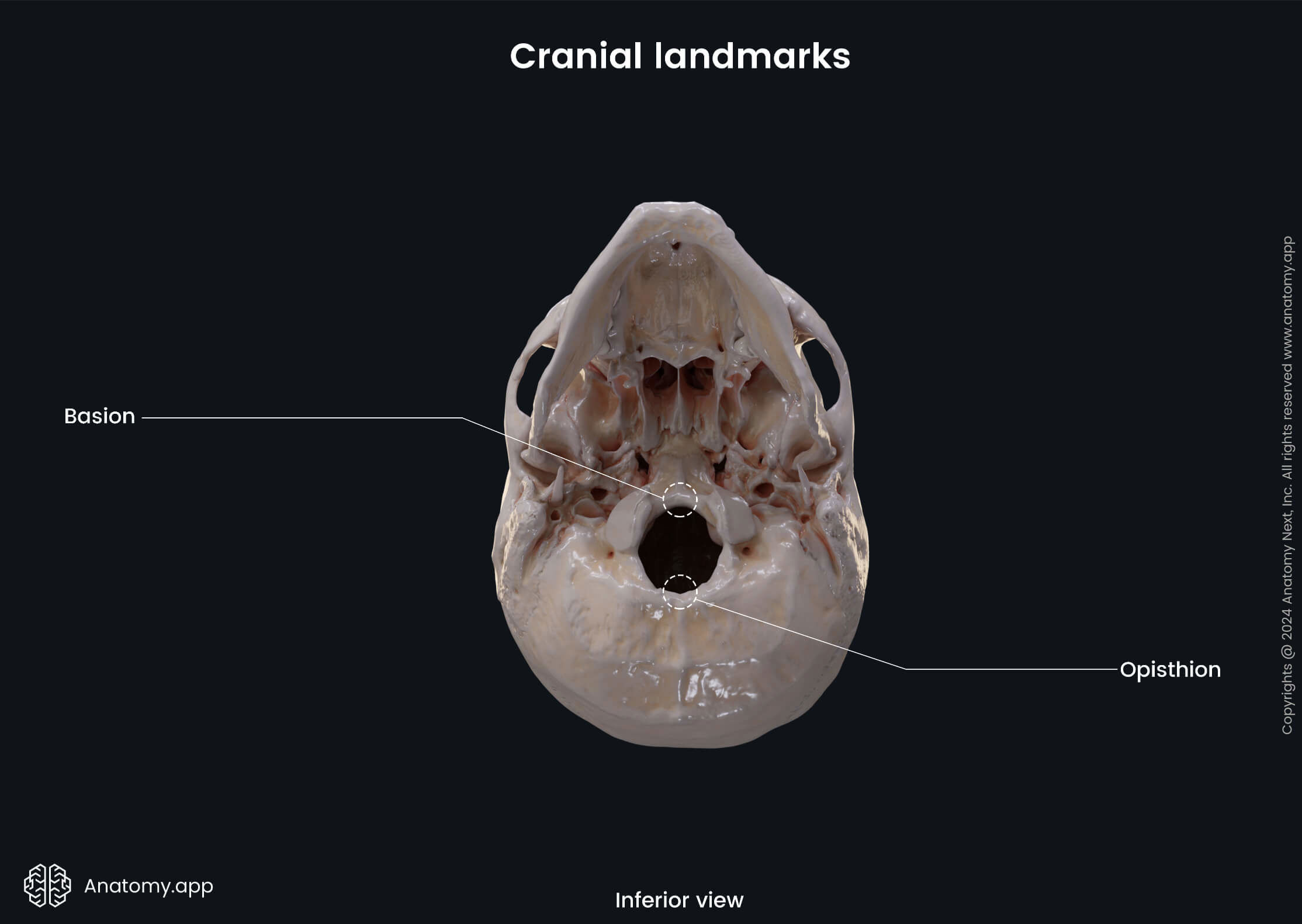 Head and neck, Skeletal system, Skull, Cranial landmarks, Skull in lateral and superior views: suture-associated cranial landmarks