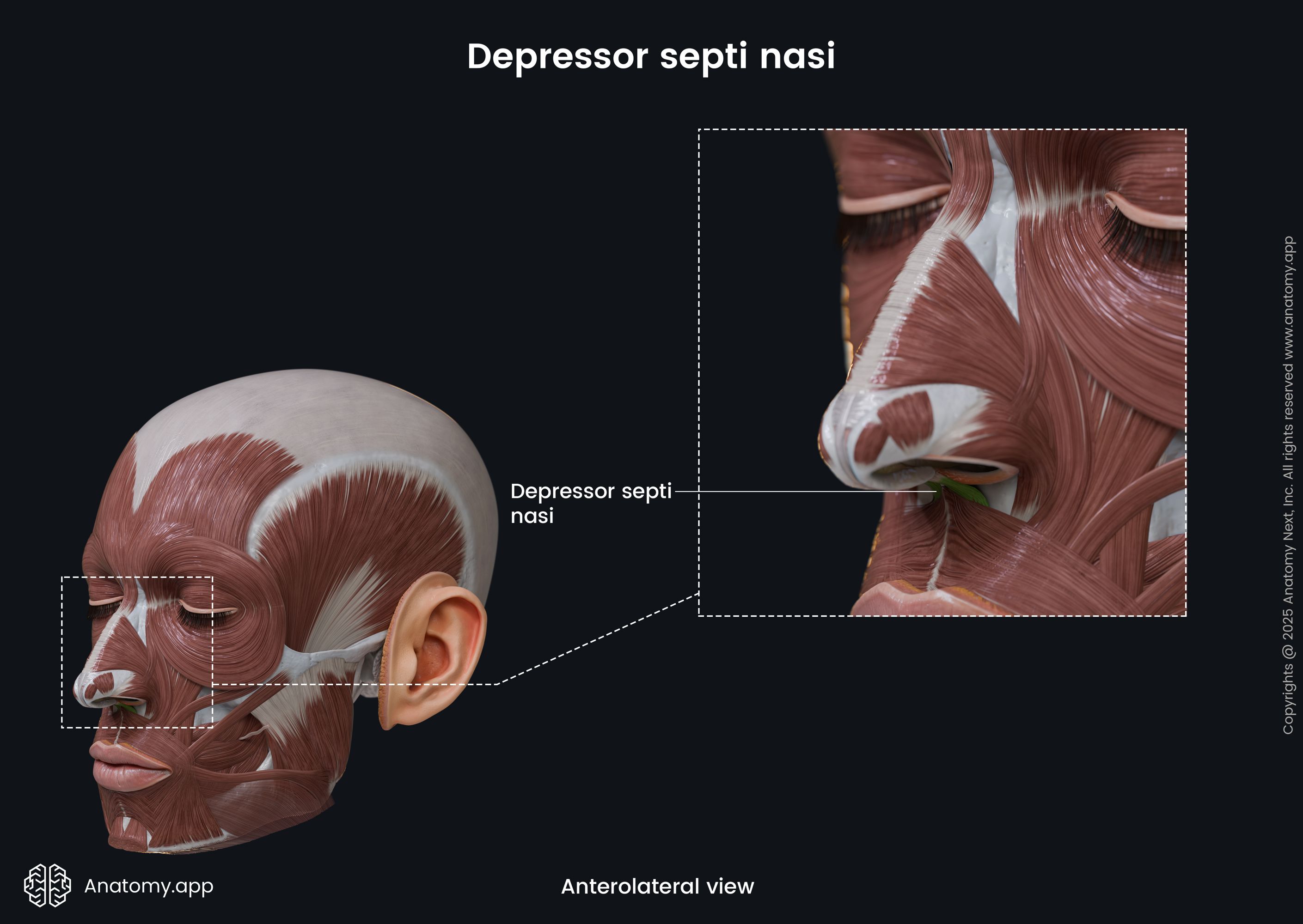 Depressor septi nasi (anterolateral view)