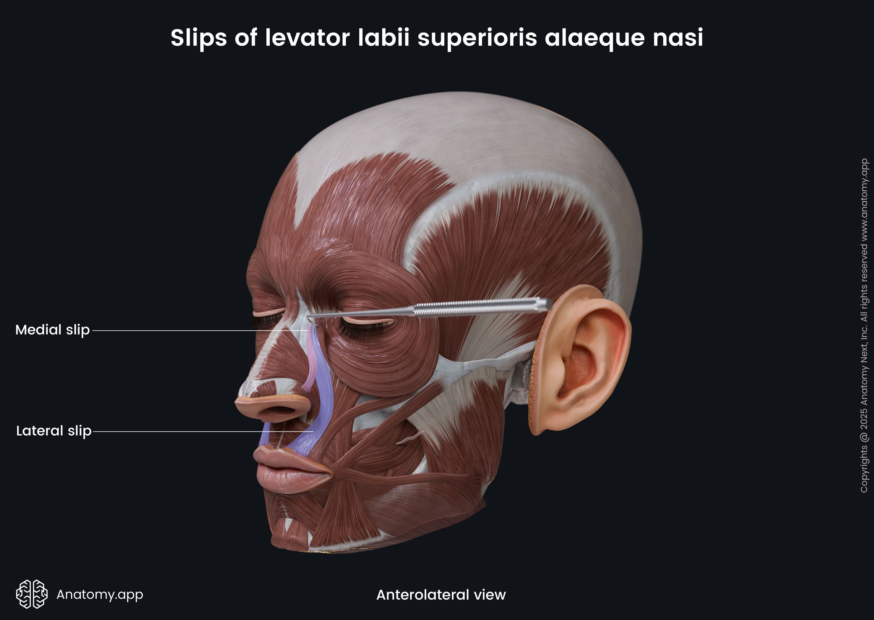 Slips of levator labii superioris alaeque nasi (anterolateral view)