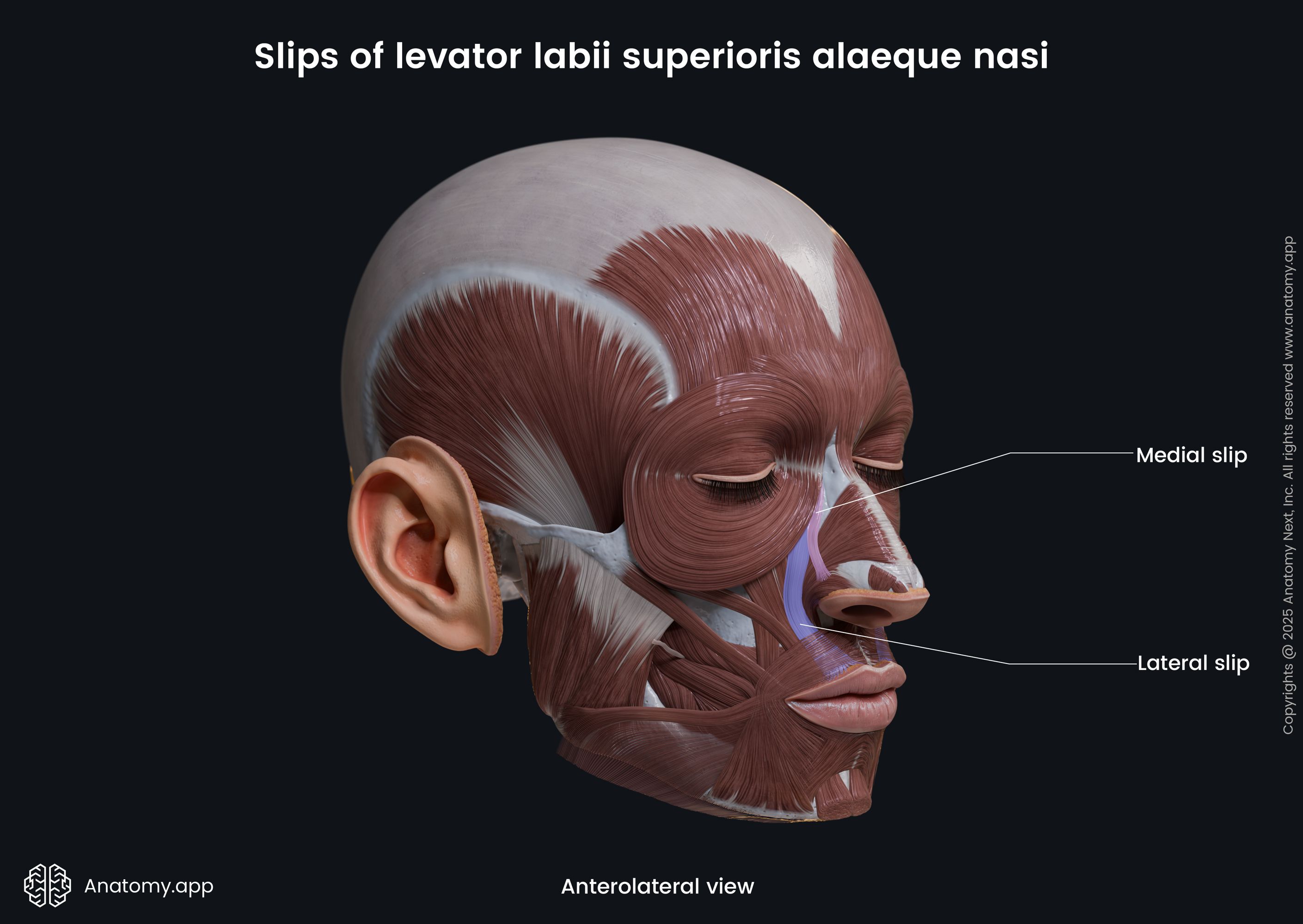 Slips of levator labii superioris alaeque nasi (anterolateral view)