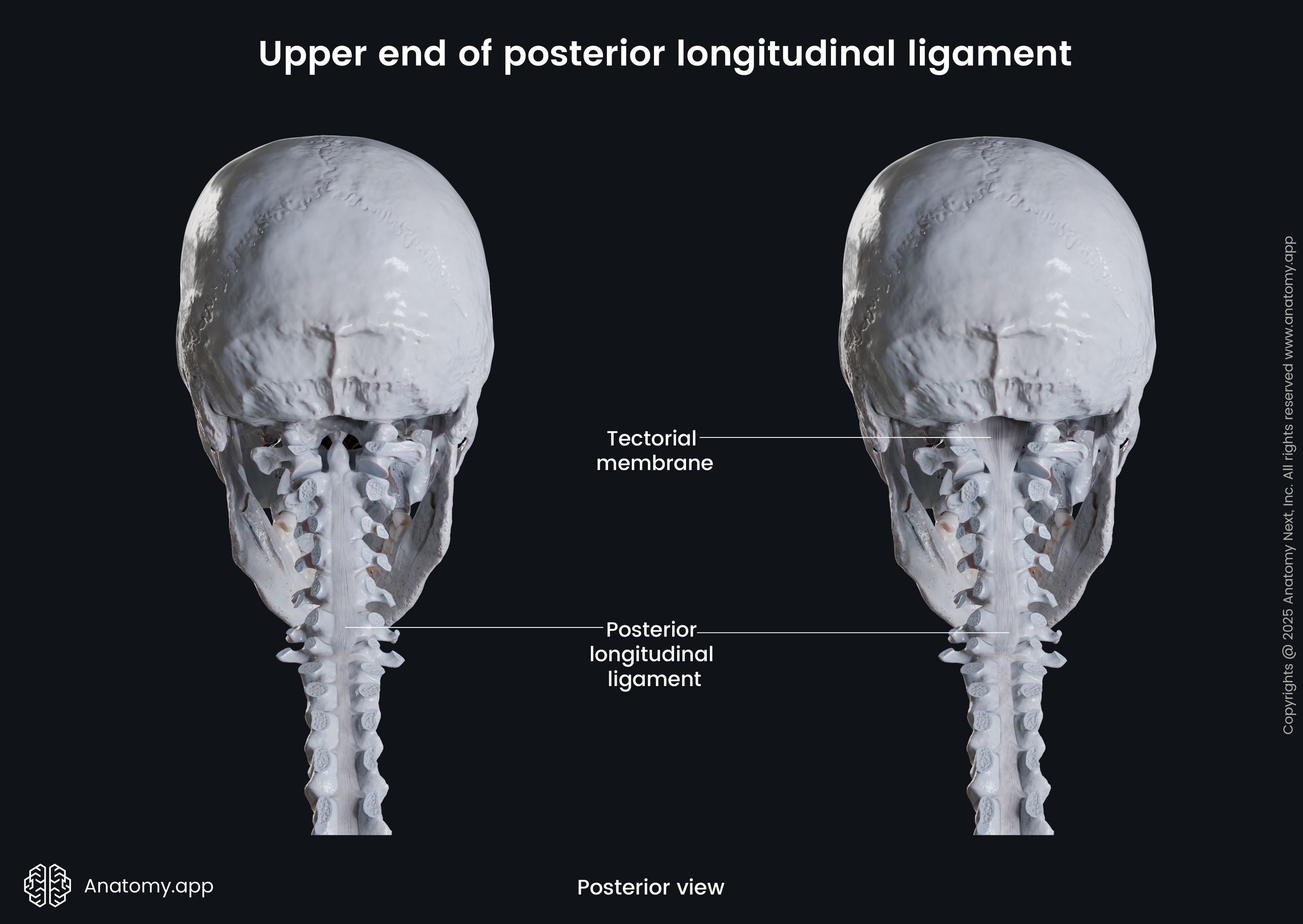Upper end of posterior longitudinal ligament