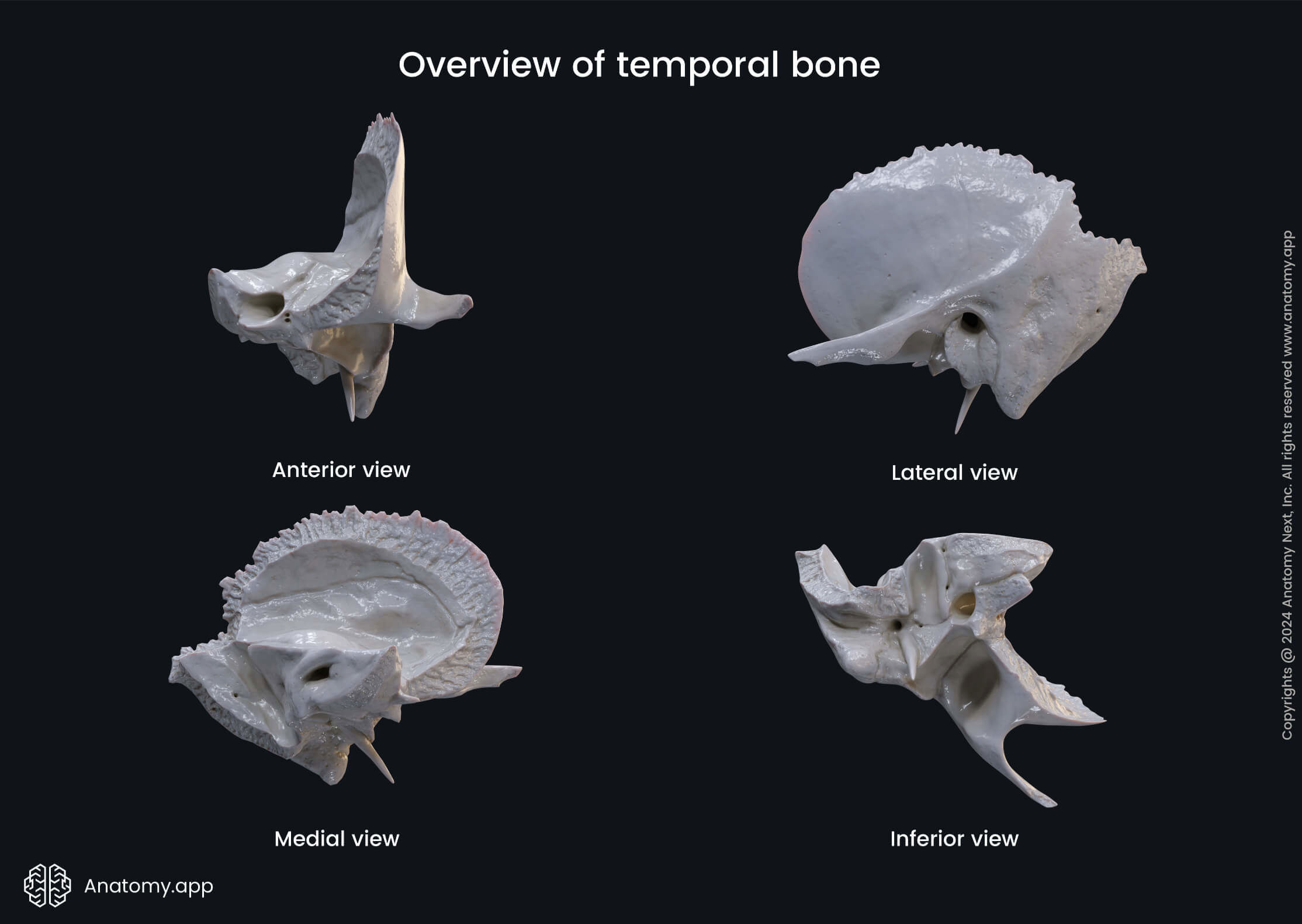 Overview of temporal bone