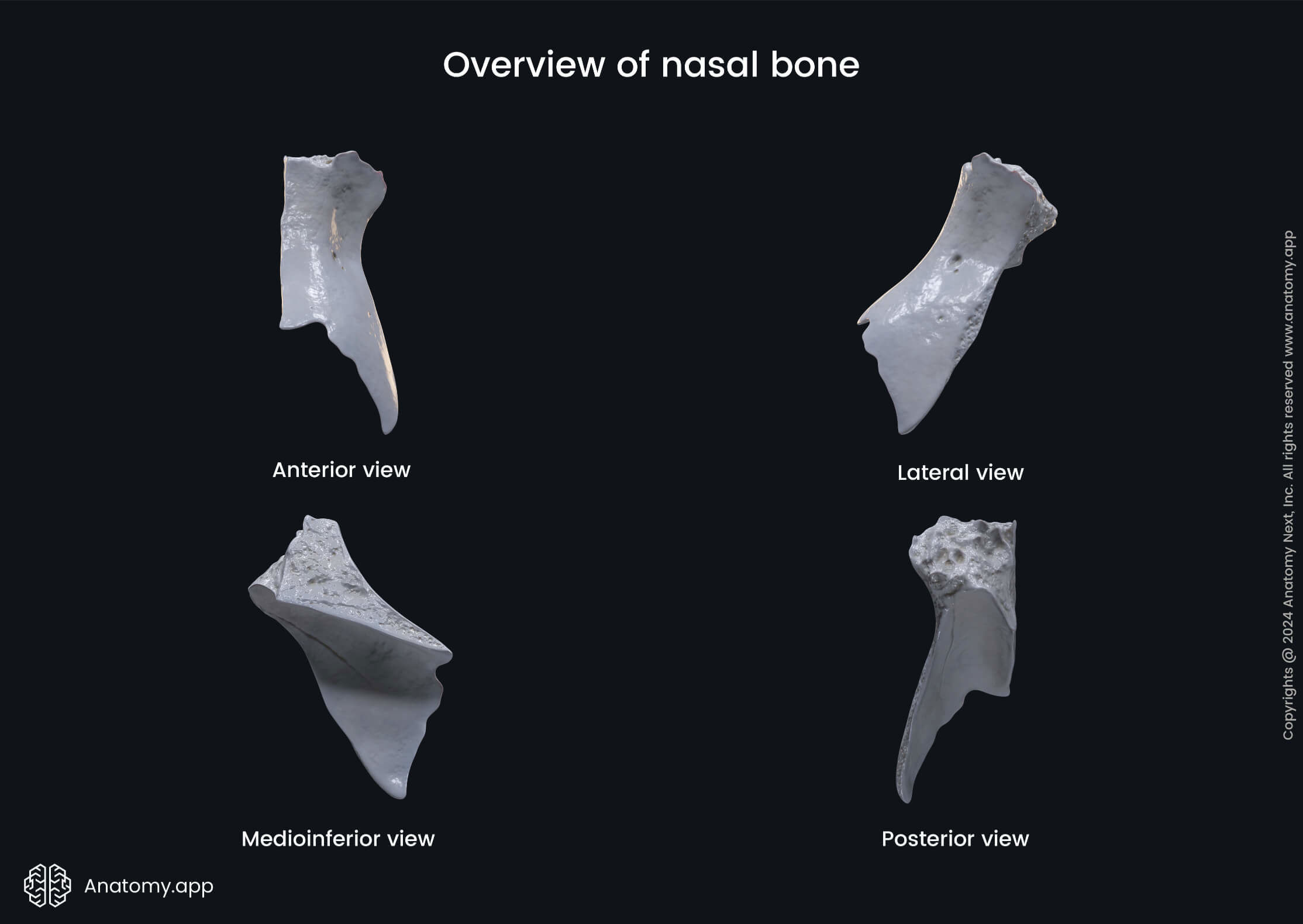 Overview of nasal bone