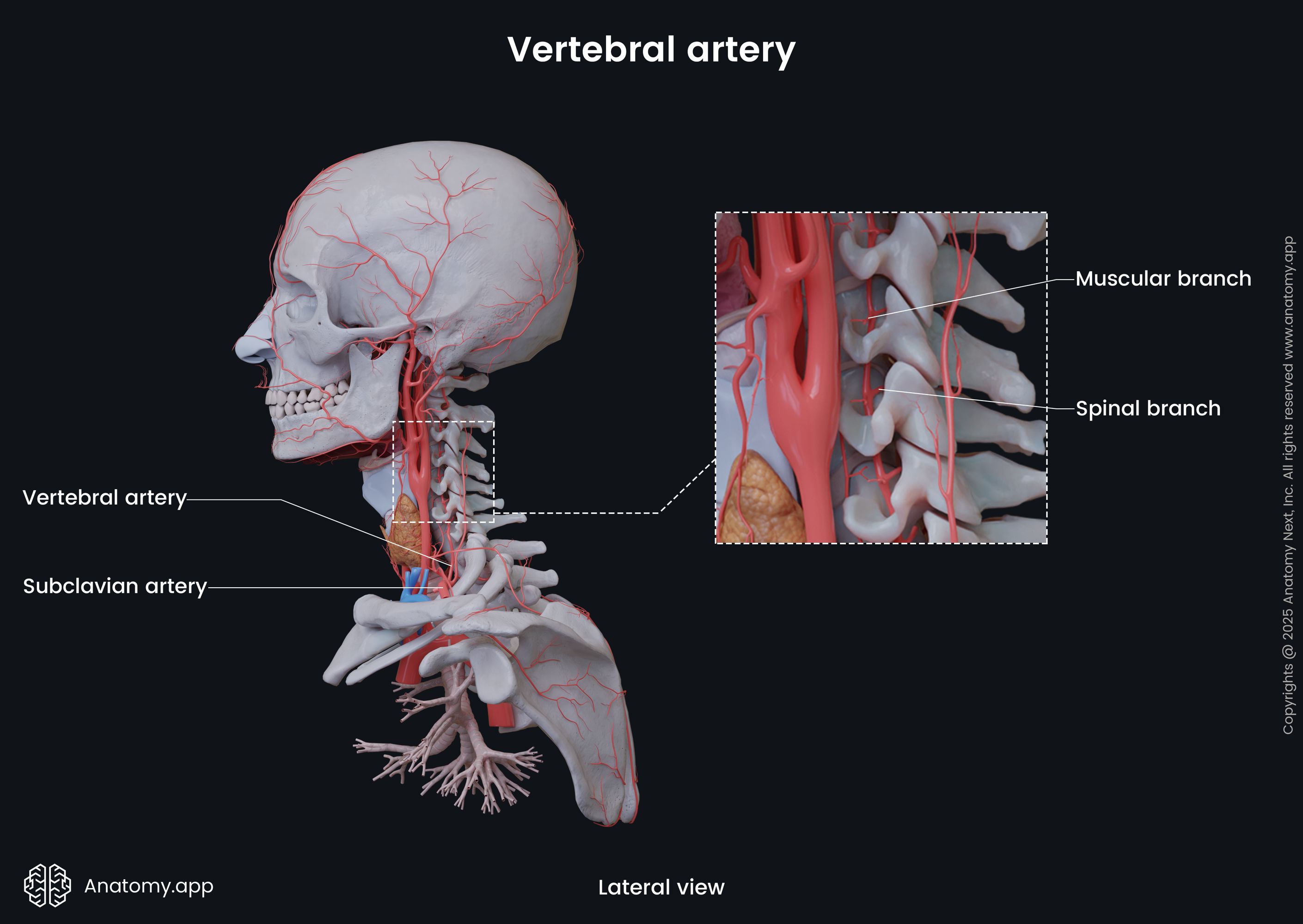 Vertebral Arteries Imaging Of Vertebral Artery Dissection In Children 