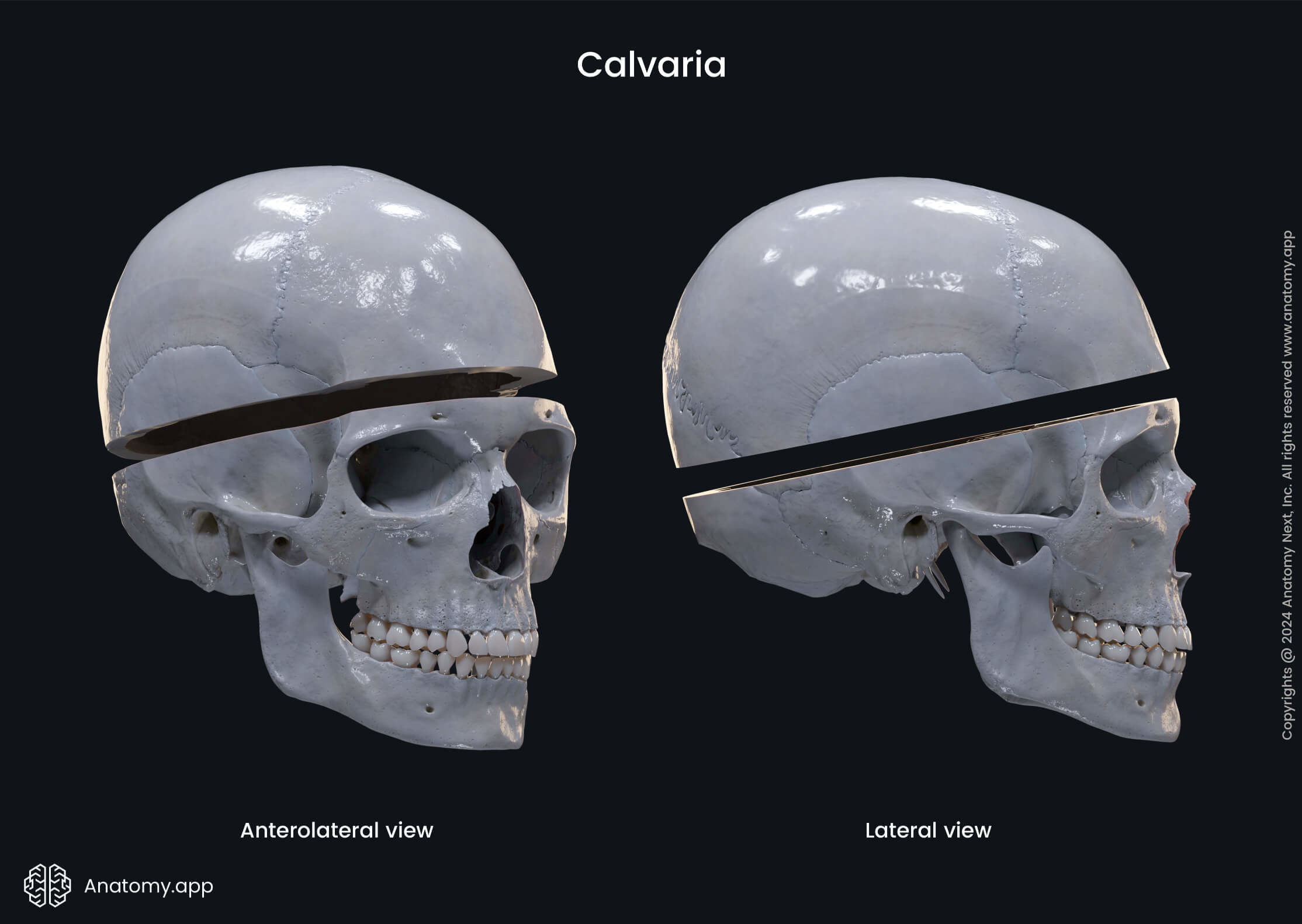 Cranial base and calvaria | Skull topography | Head and Neck | Anatomy ...