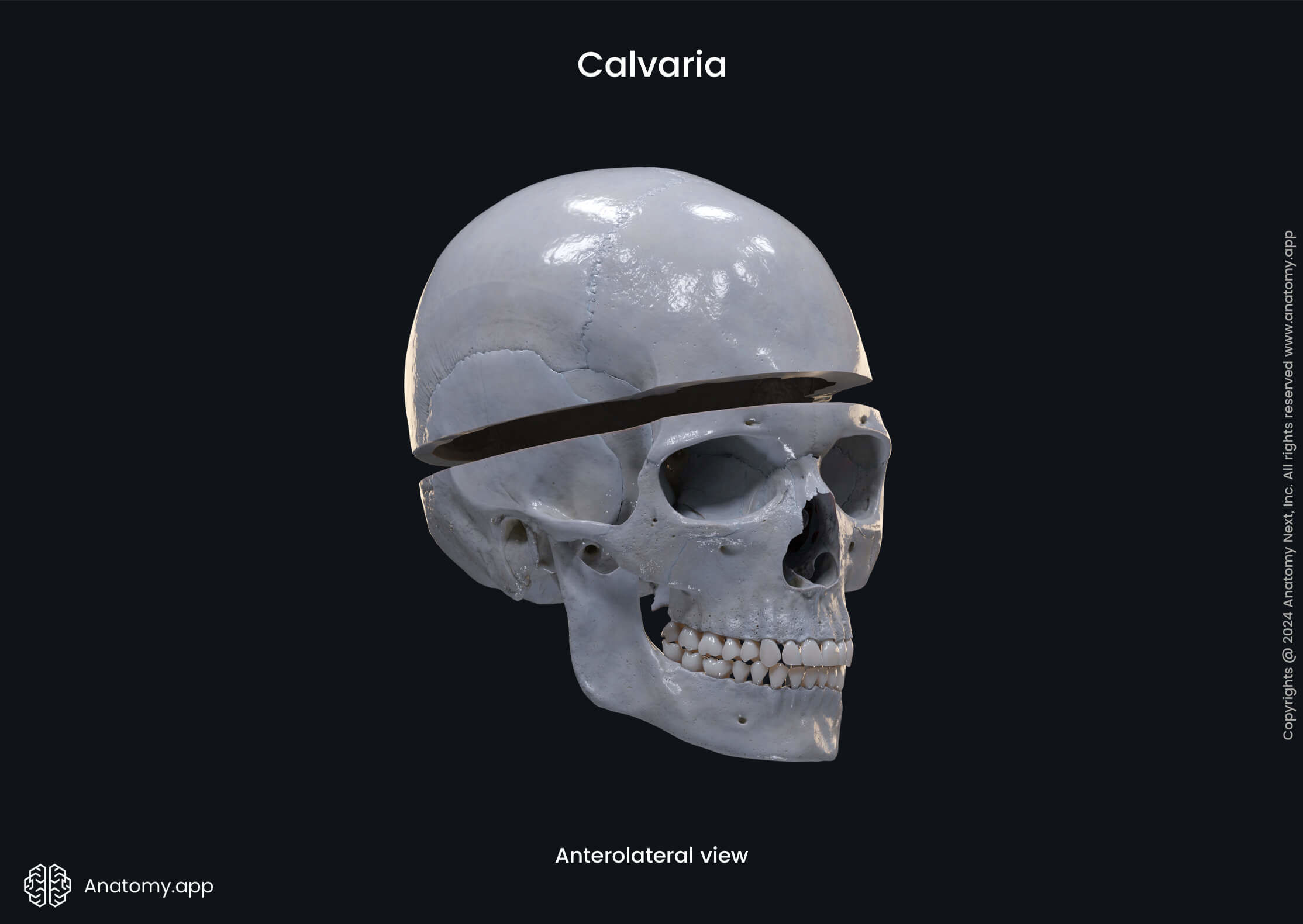 Calvaria (anterolateral view)