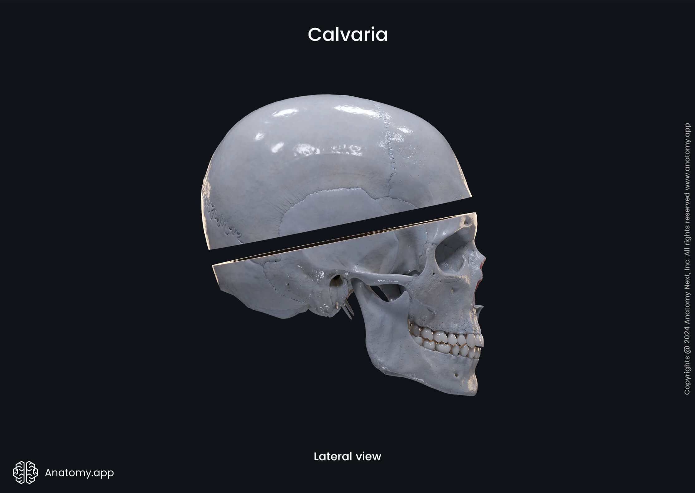 Calvaria (lateral view)