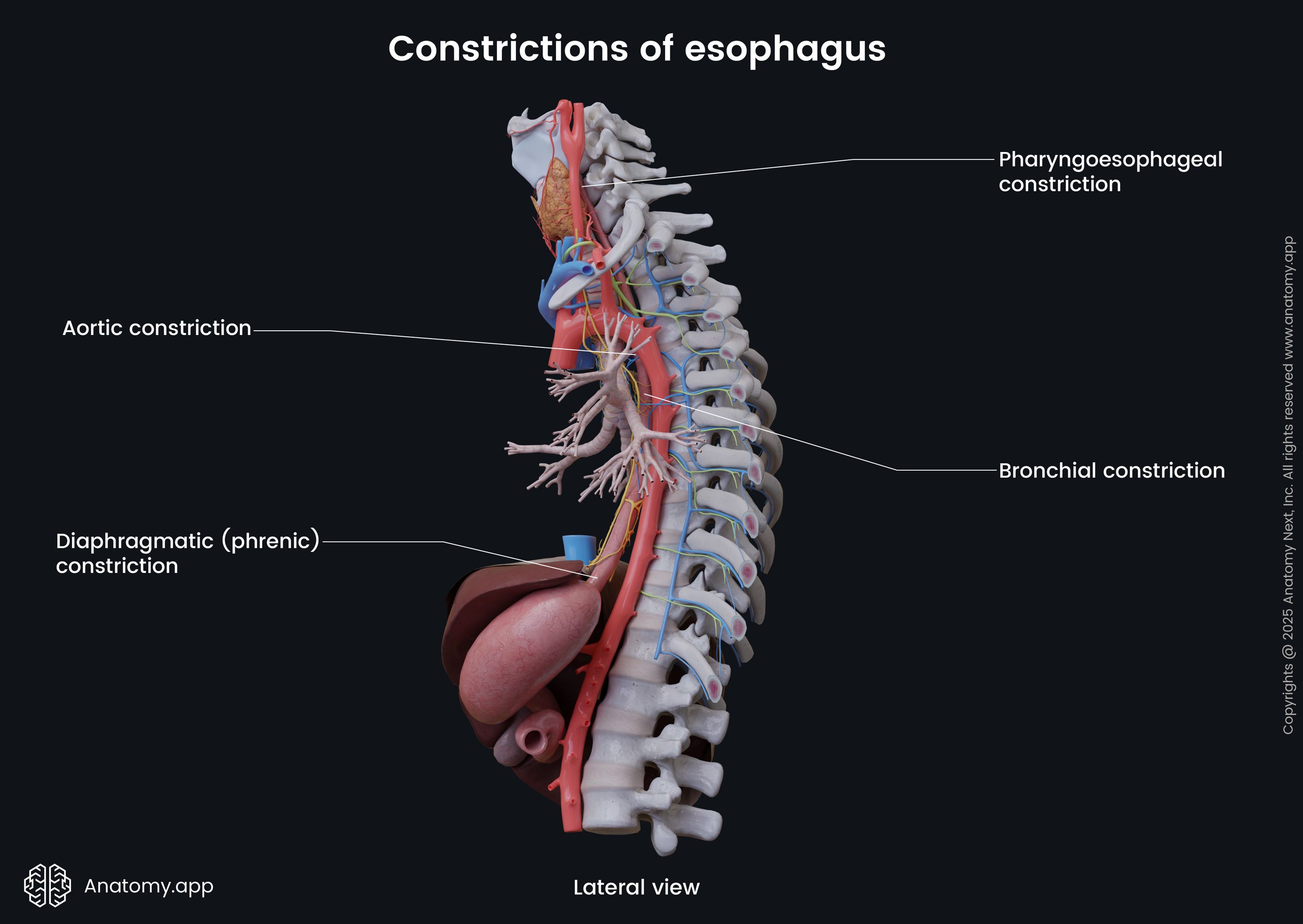 Constrictions of esophagus