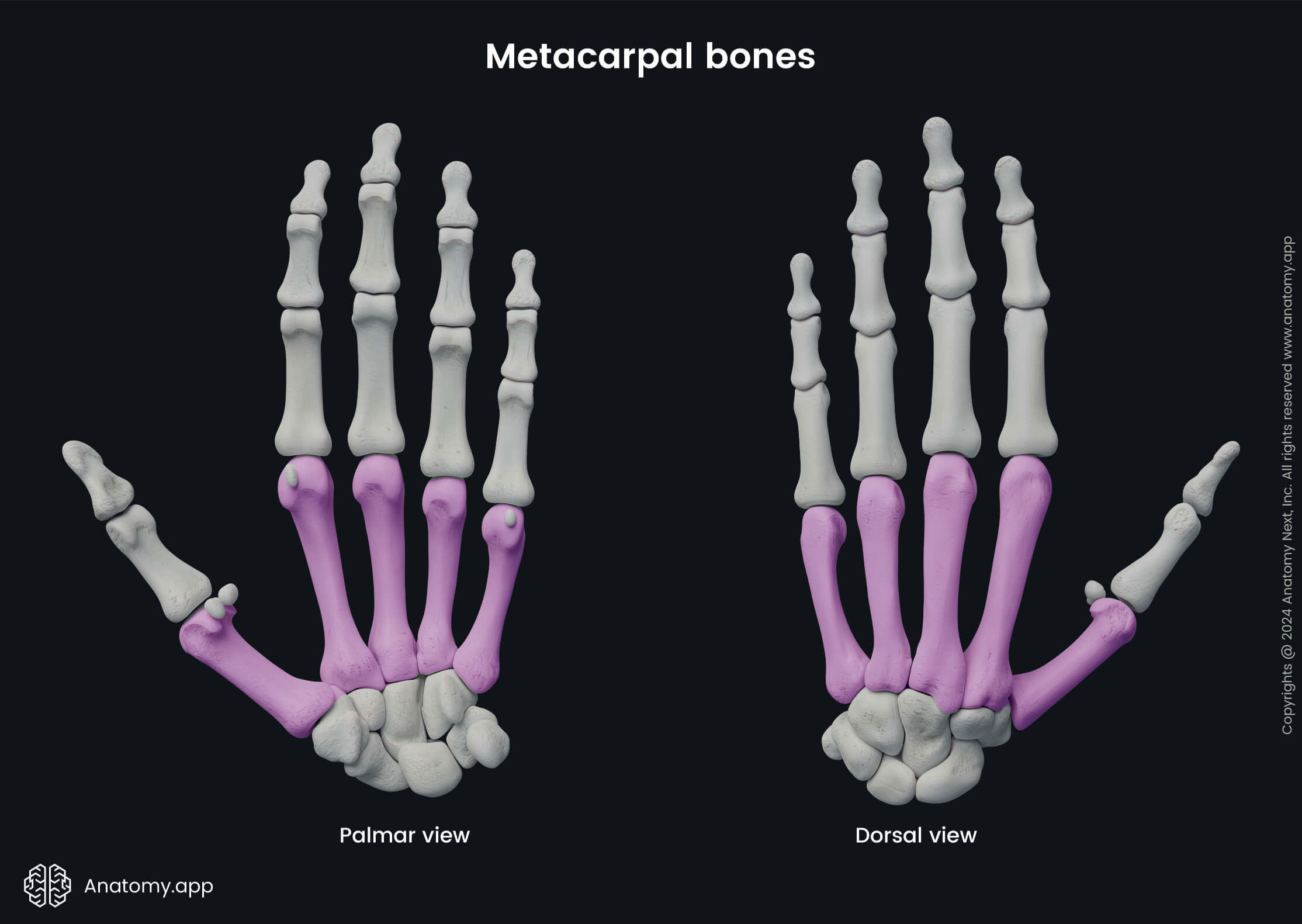 Metacarpal bones