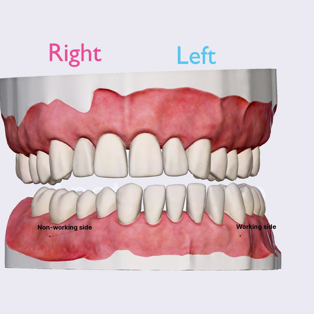 lateral excursion meaning dental