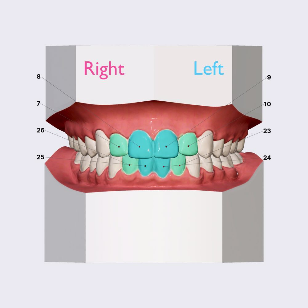 Incisors (overview)