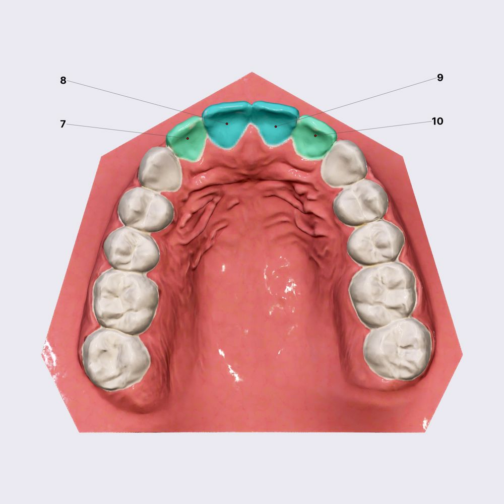 Maxillary incisors