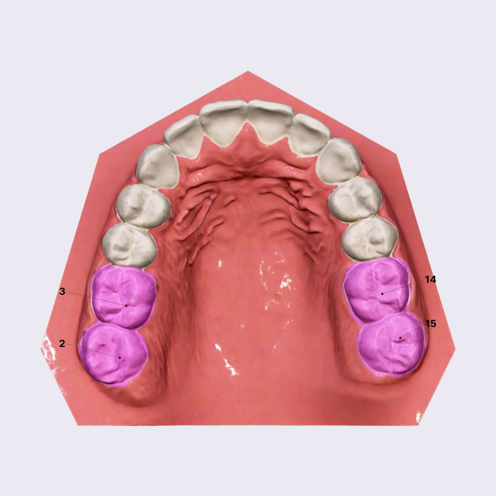 Maxillary molars