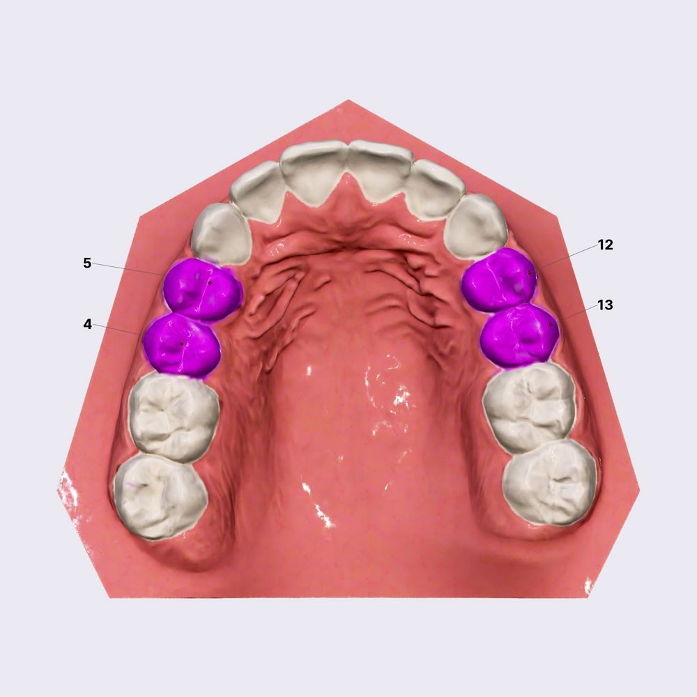 Maxillary premolars