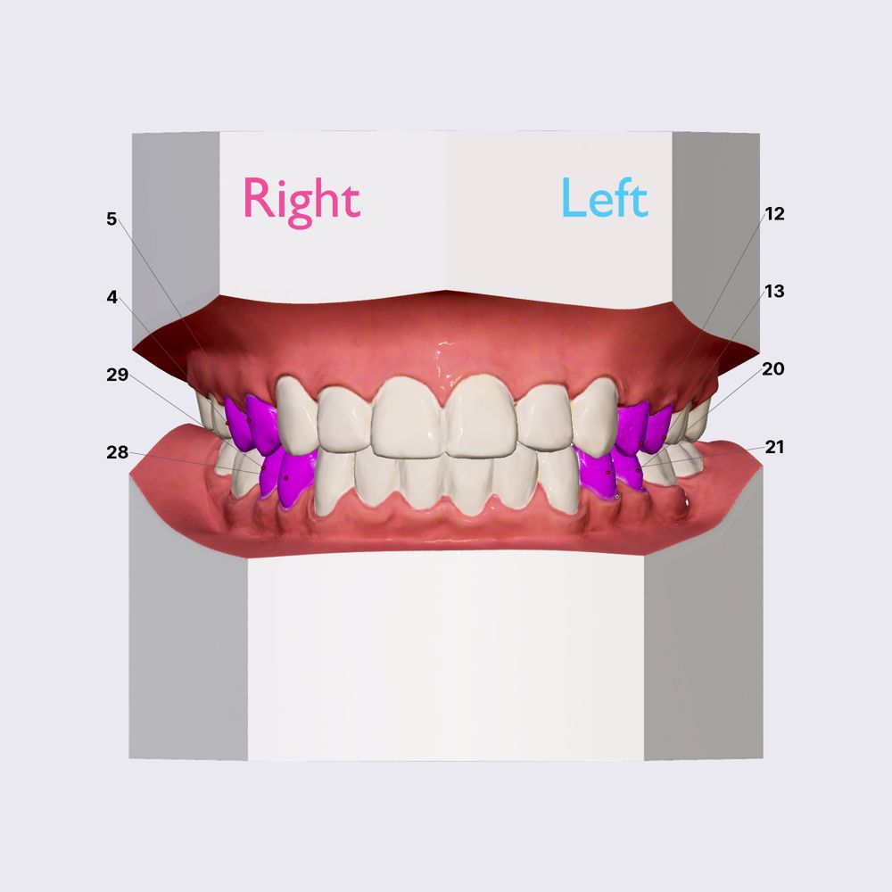 Premolars (overview)