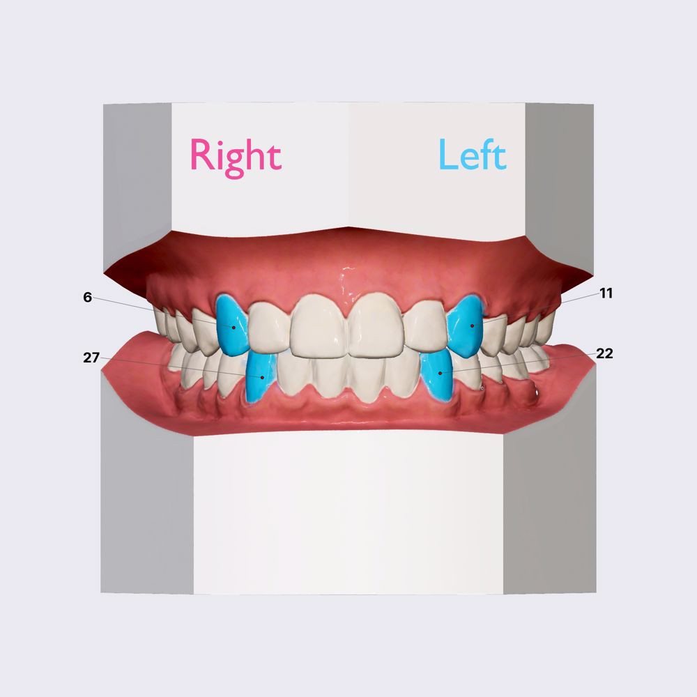 Canines (overview)