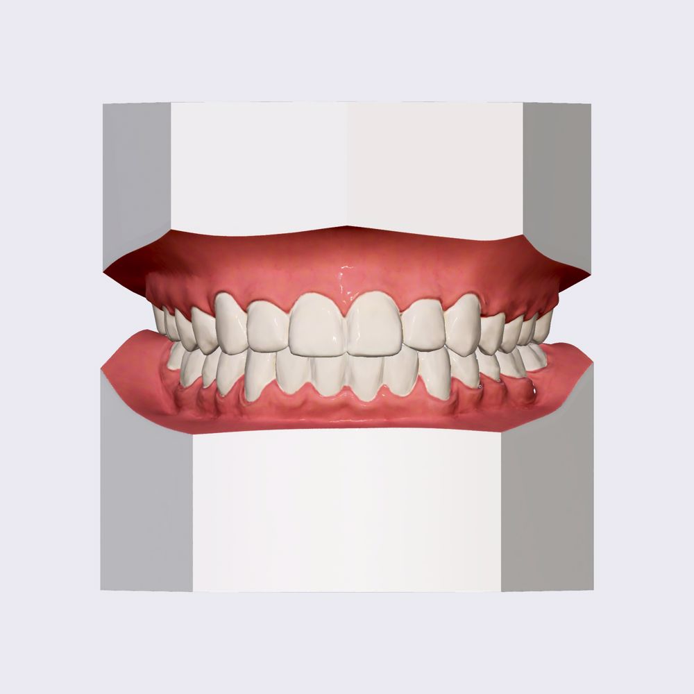 Dental notation systems (overview)