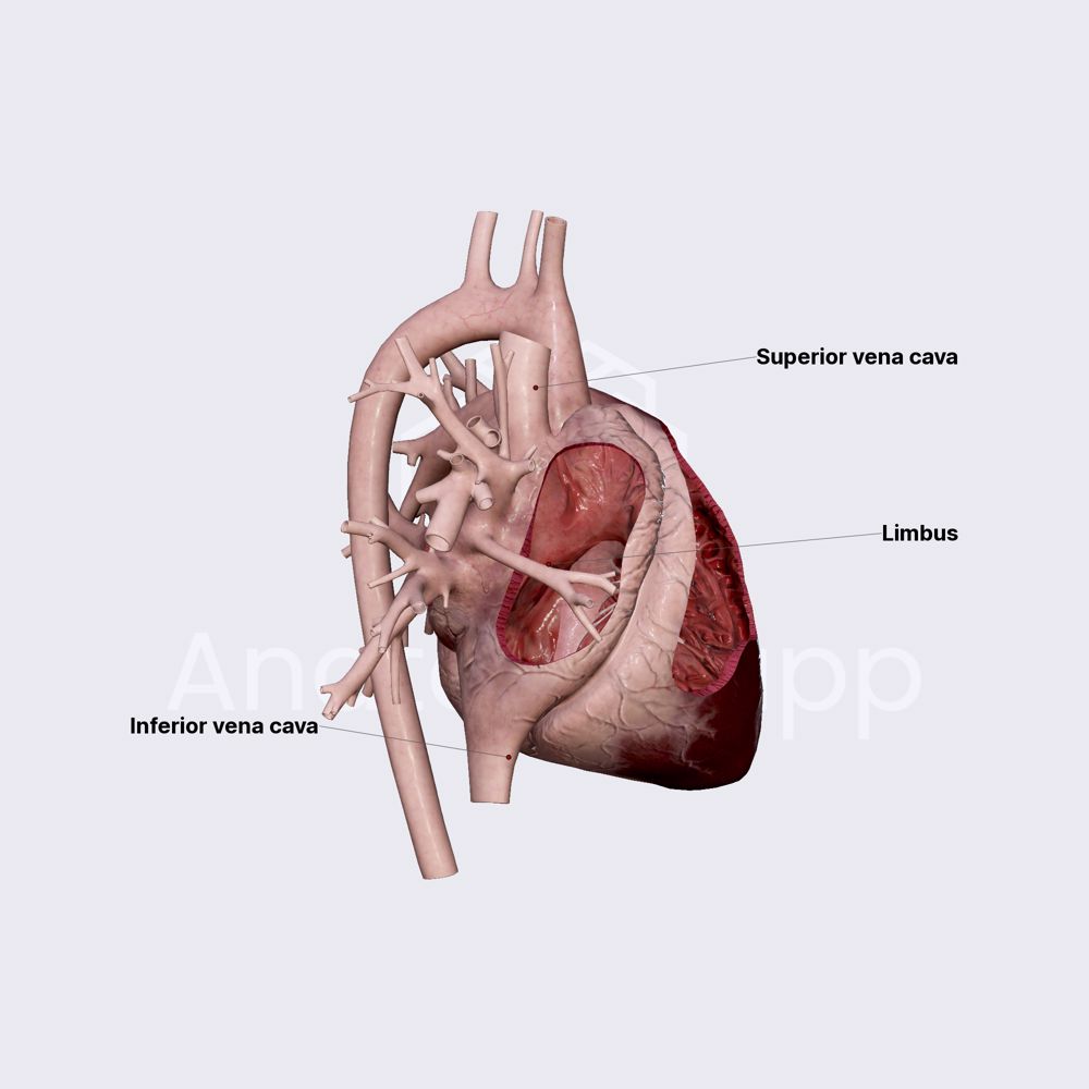 Right atrium (RA)