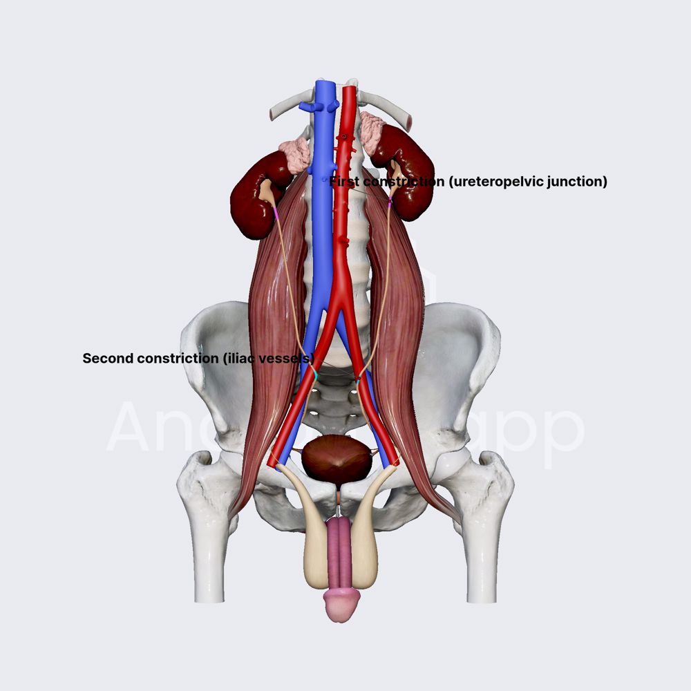 Constrictions of ureters