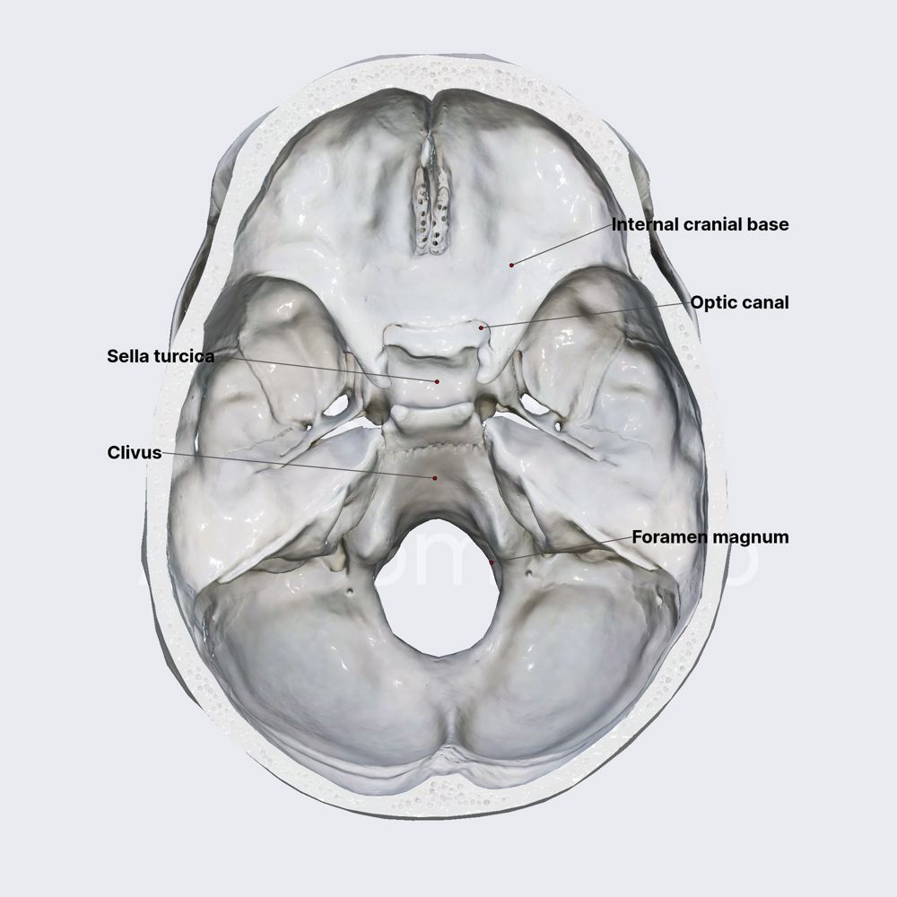 Internal cranial base