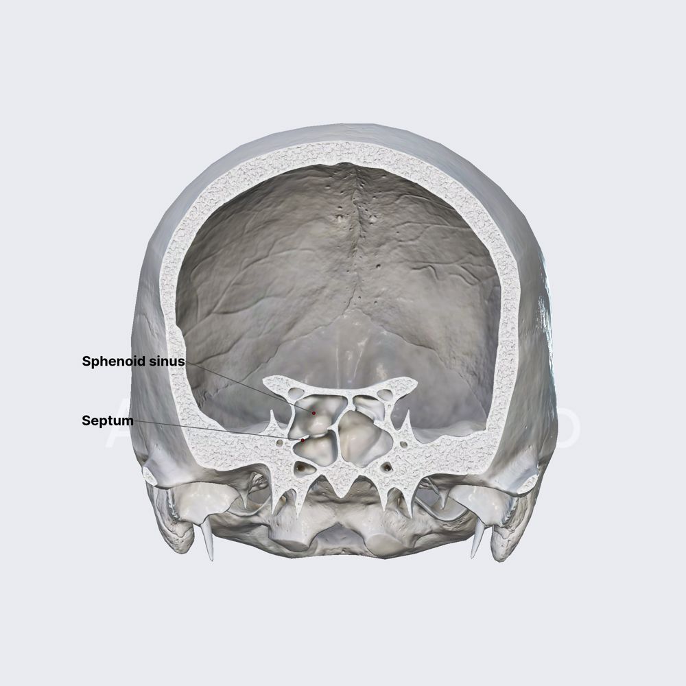 Sphenoid sinus