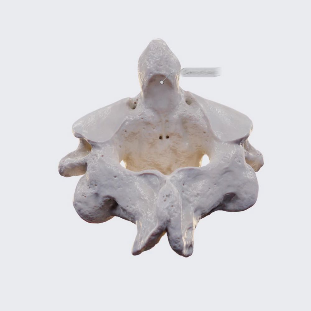 Second cervical vertebra (axis; C2)