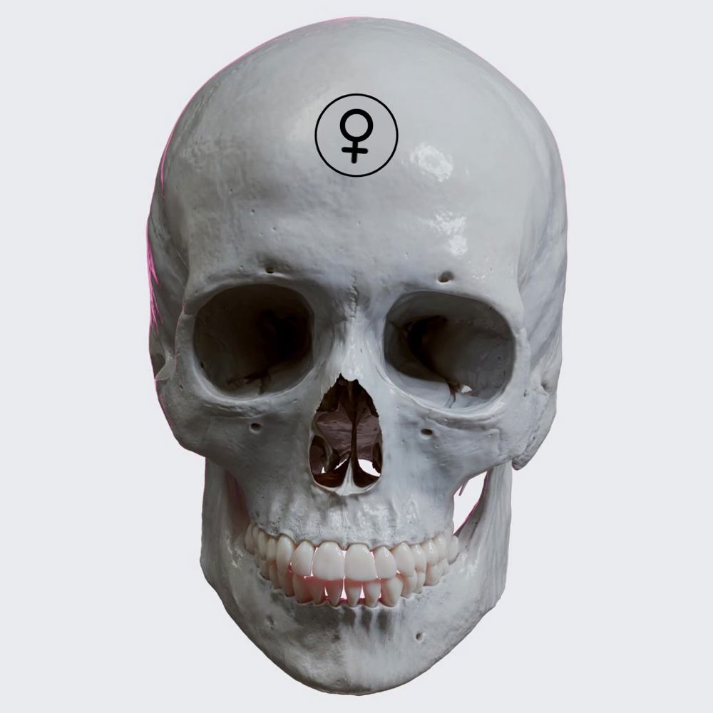Male vs. female skull