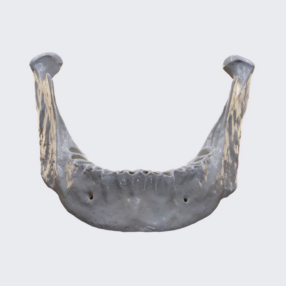 Mandible (overview)