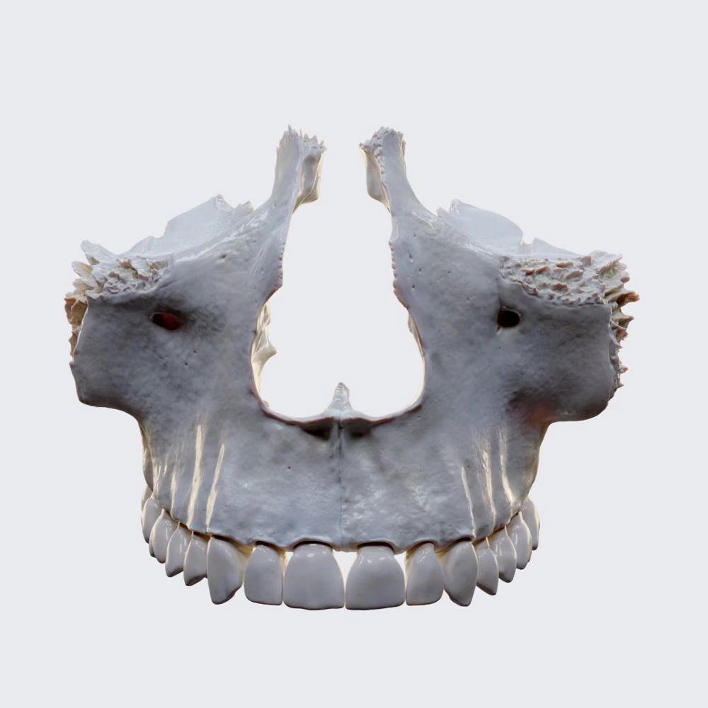 Maxilla