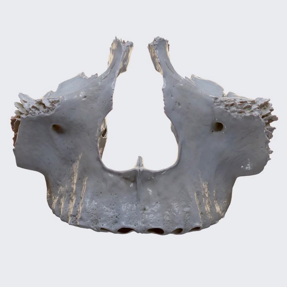 Maxilla (overview)