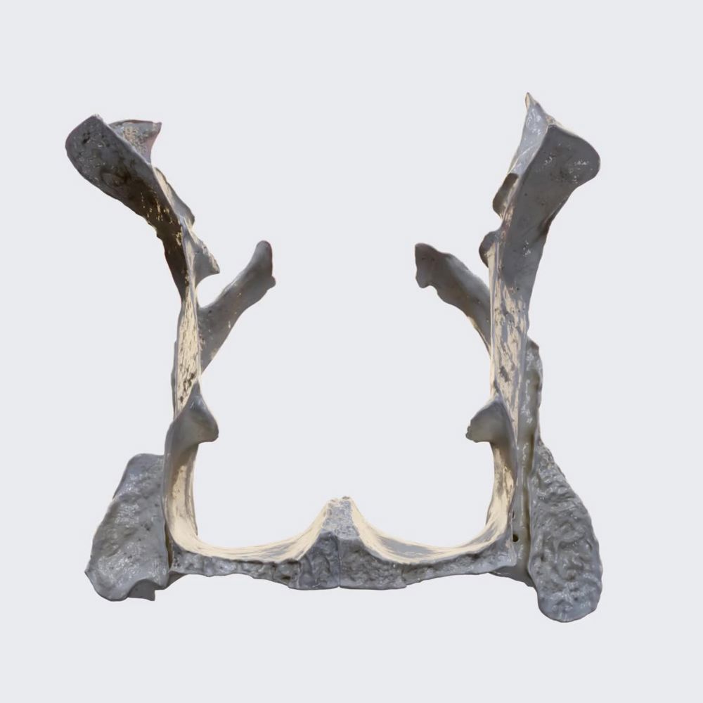 Palatine bone (overview)