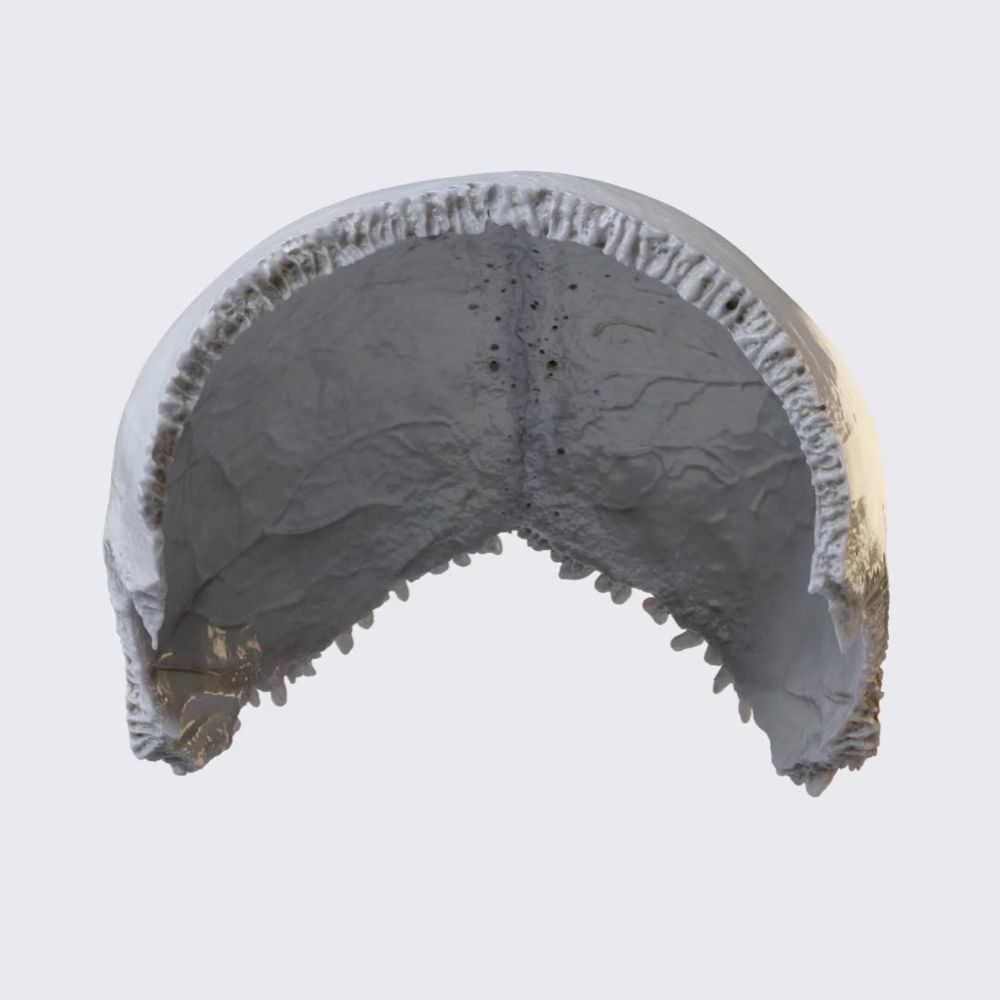 Overview of parietal bones