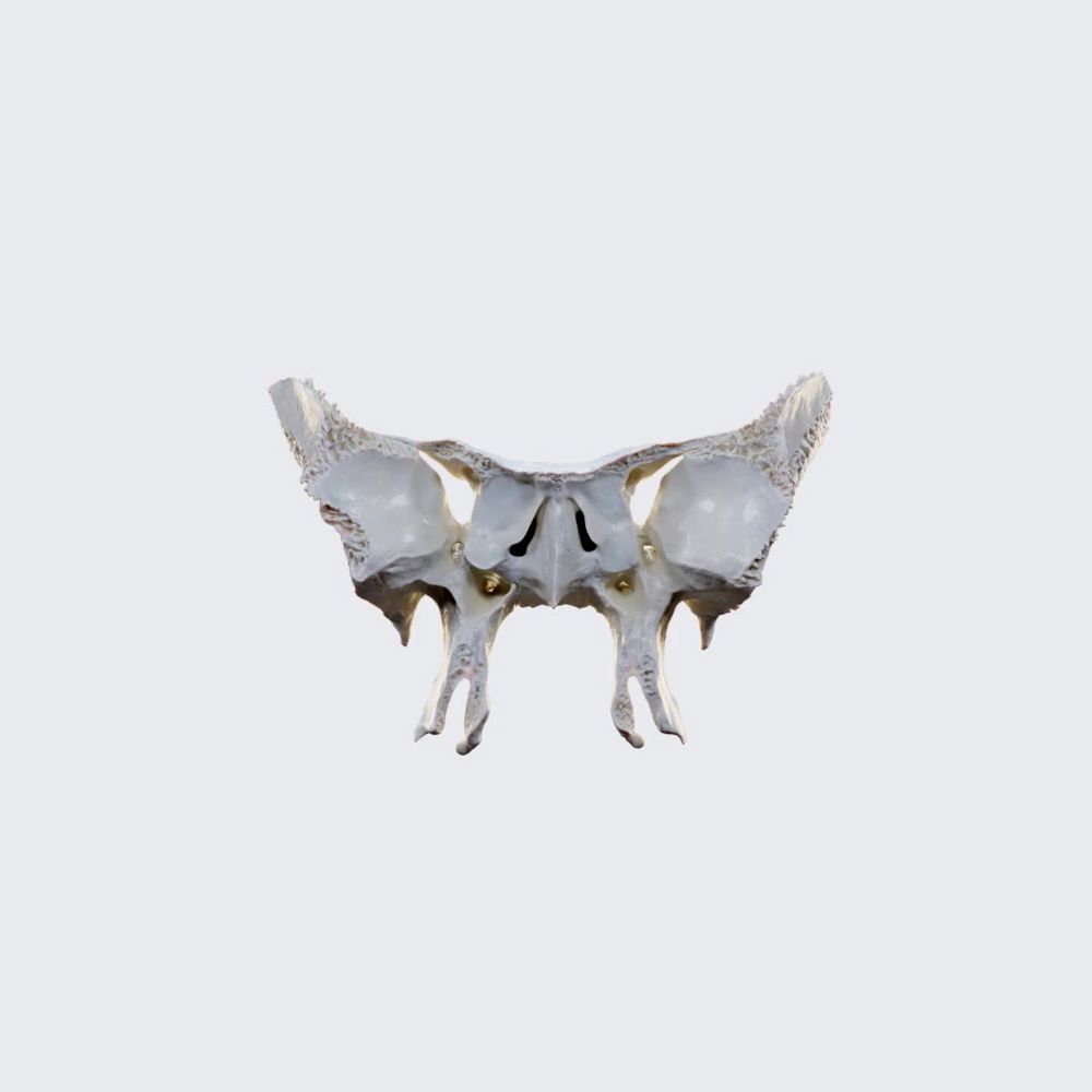 Sphenoid bone