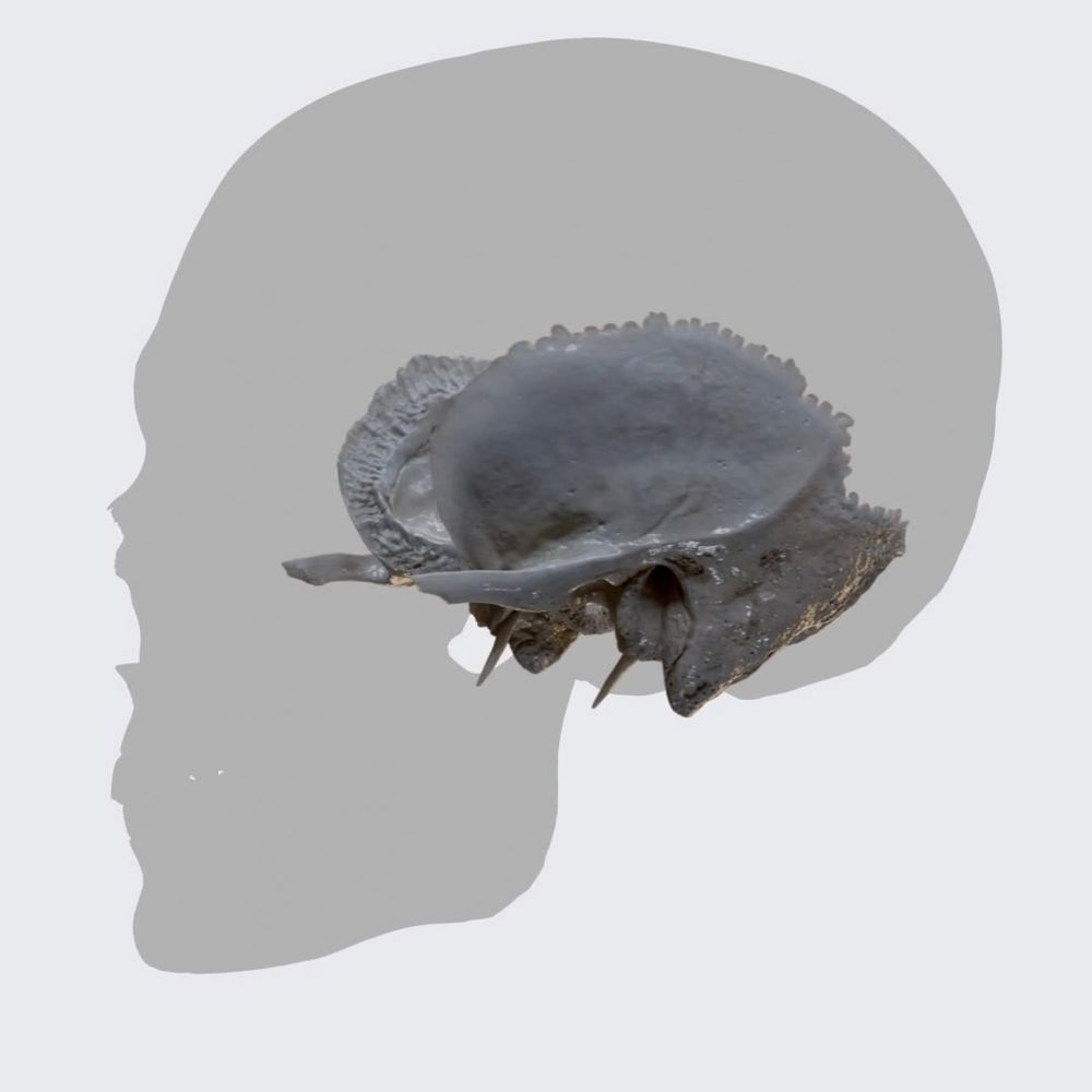 Temporal bone (overview)