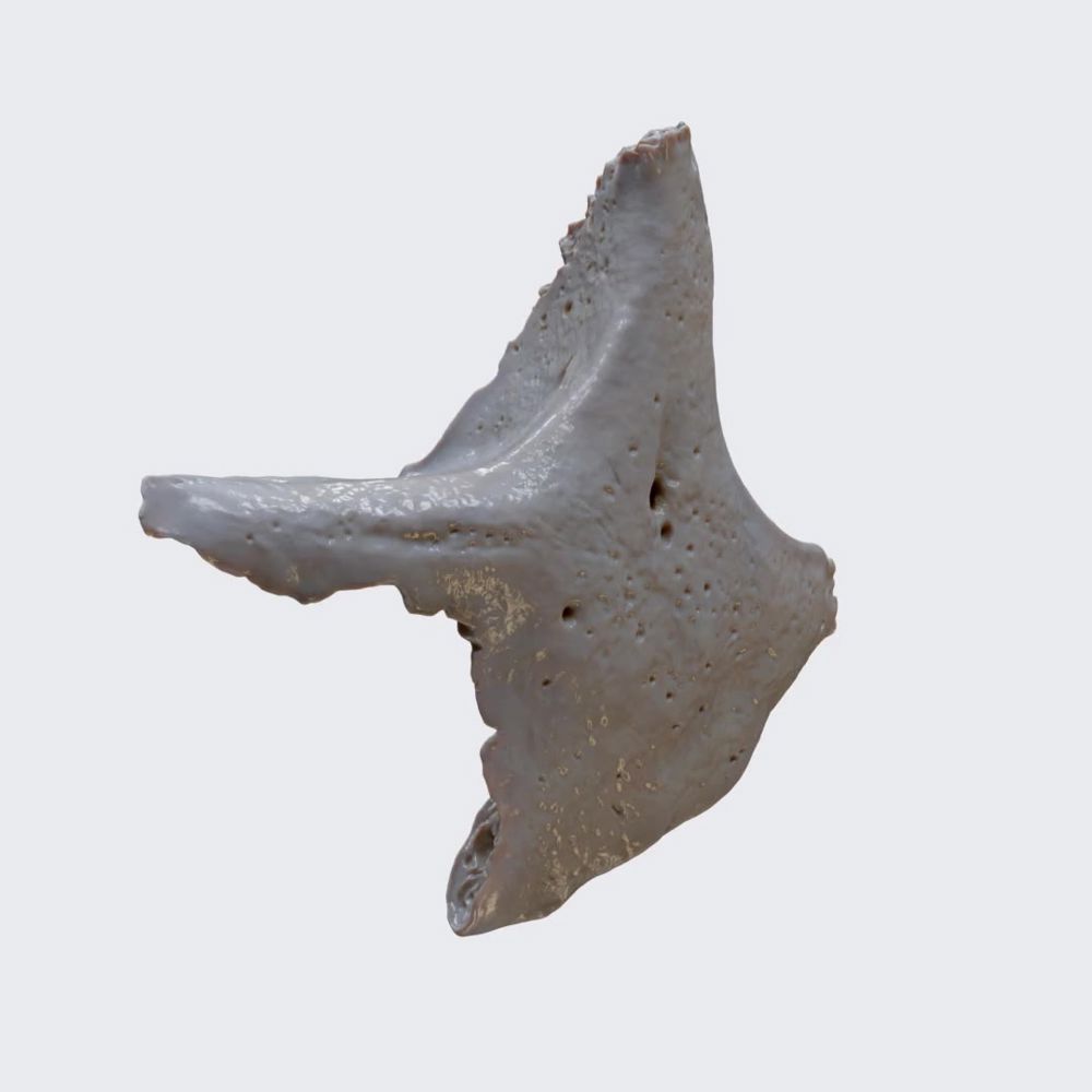 Zygomatic bone